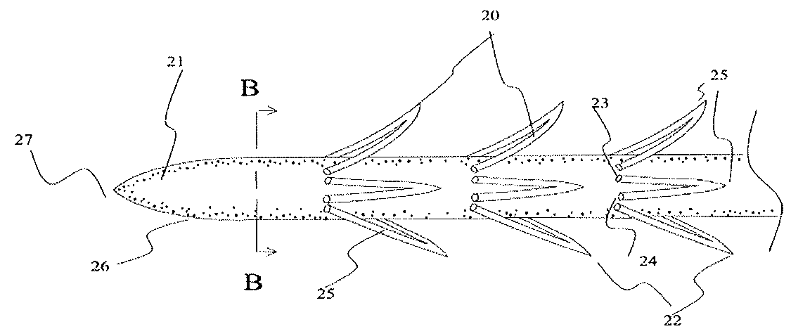 Barbed suture