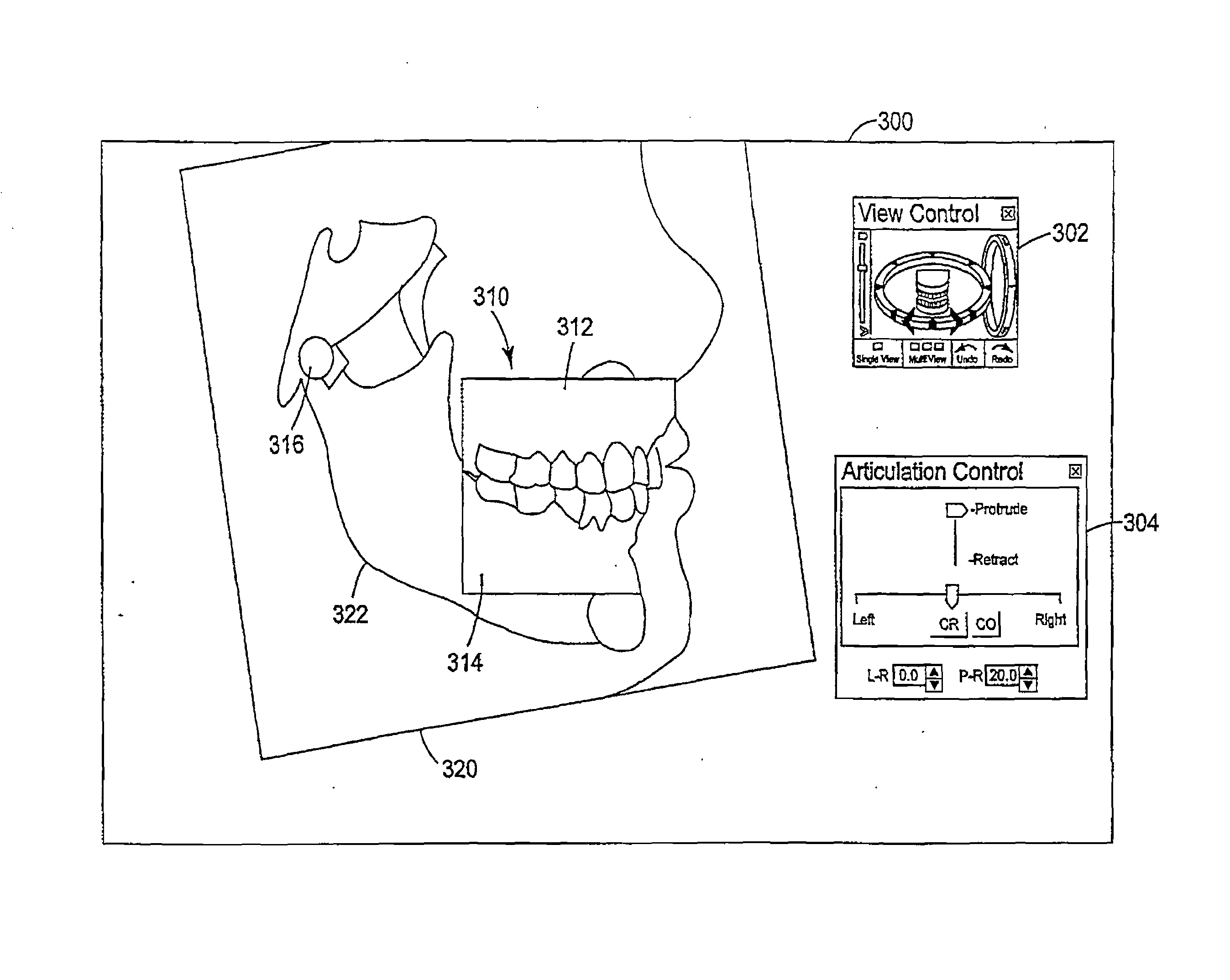 Methods for use in dental articulation