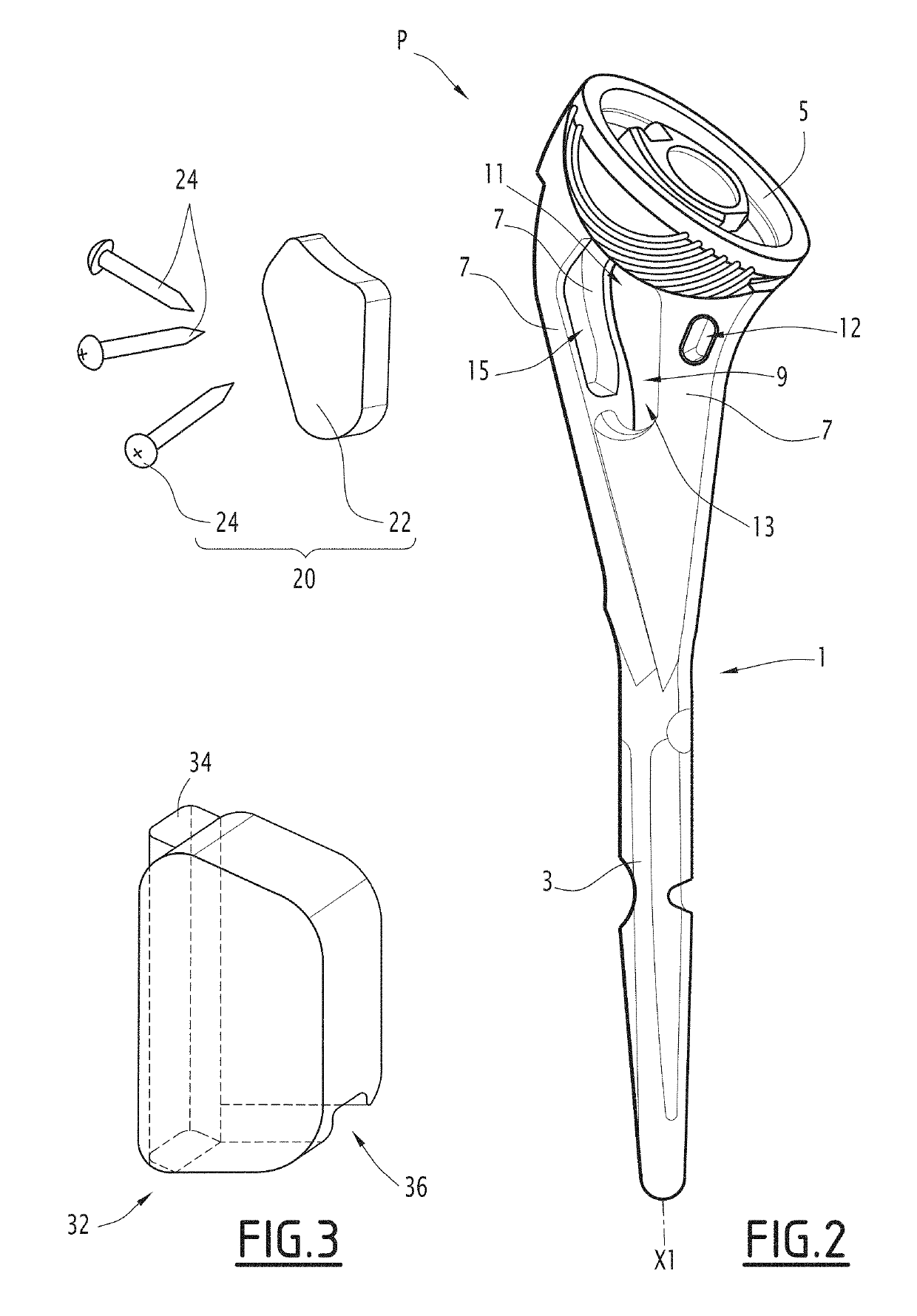 Prosthesis for a fractured long bone