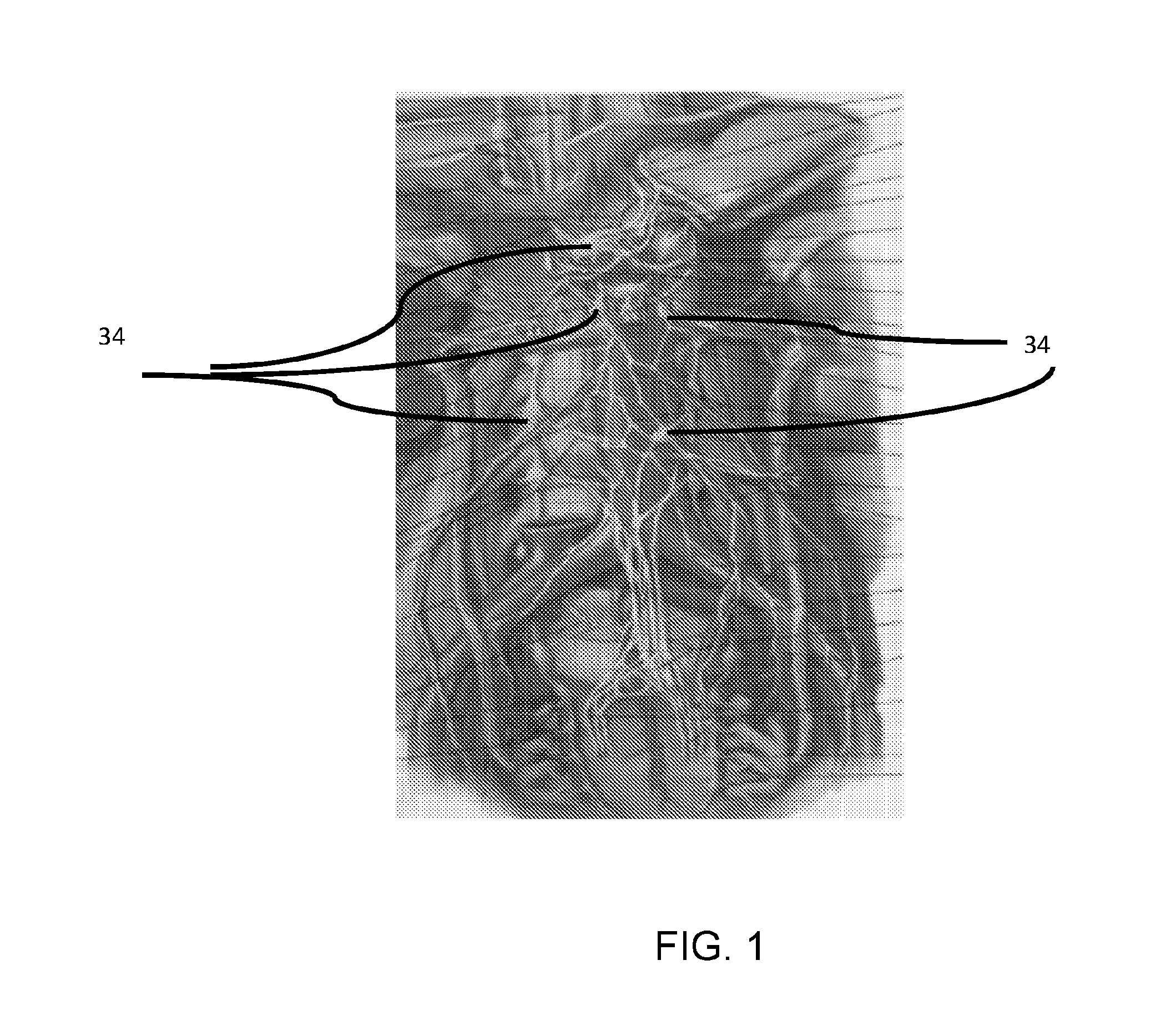 Dual catheter ablation system