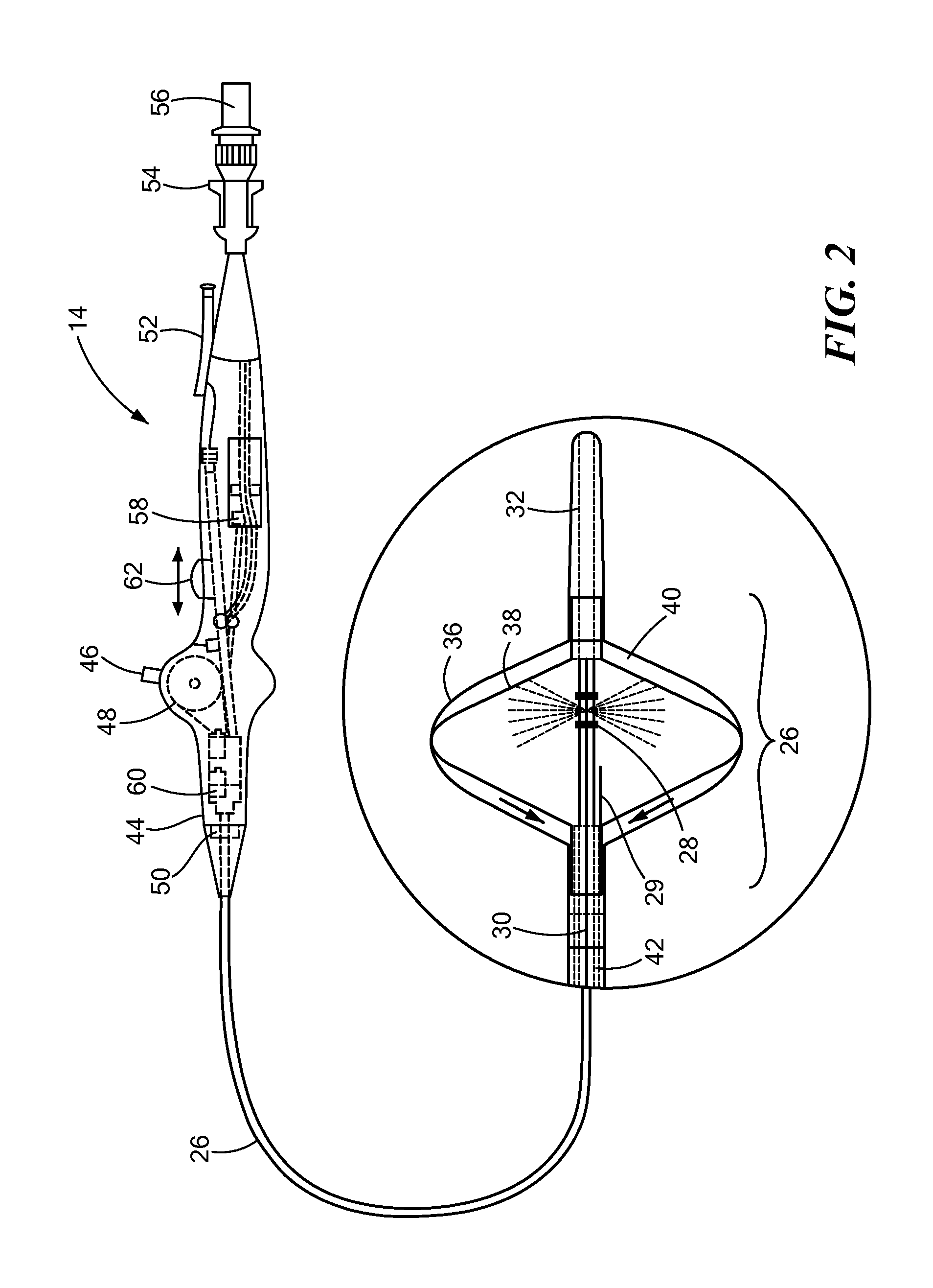 Dual injection tube cryocatheter and method for using same