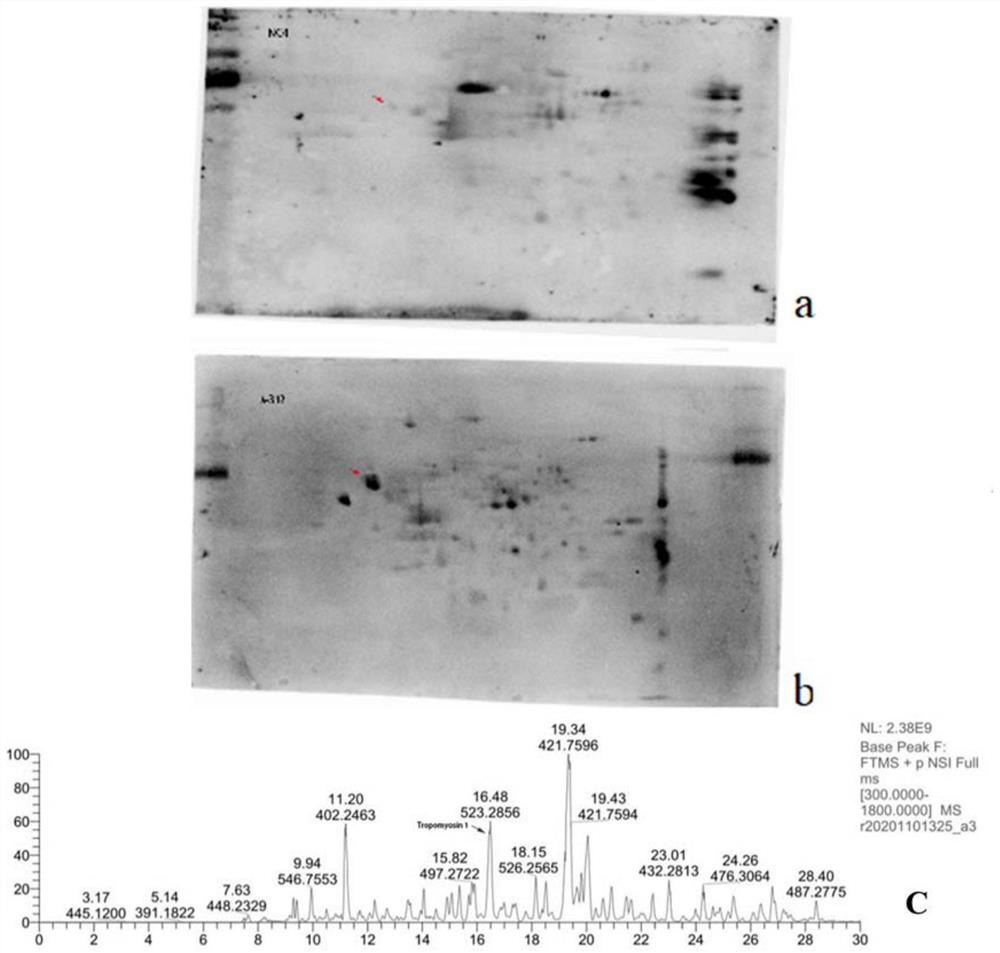 Kit for detecting antigen myosin 1-IgG antibody