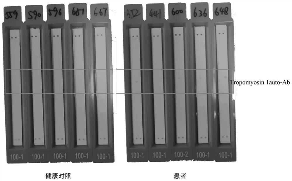 Kit for detecting antigen myosin 1-IgG antibody