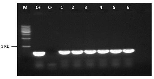 Multi-copy expression vector, pichia pastoris expressing plectasin and preparation method thereof