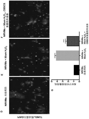 Augmenting heart function after cardiac injury with exosomes derived from cortical bone stem cells