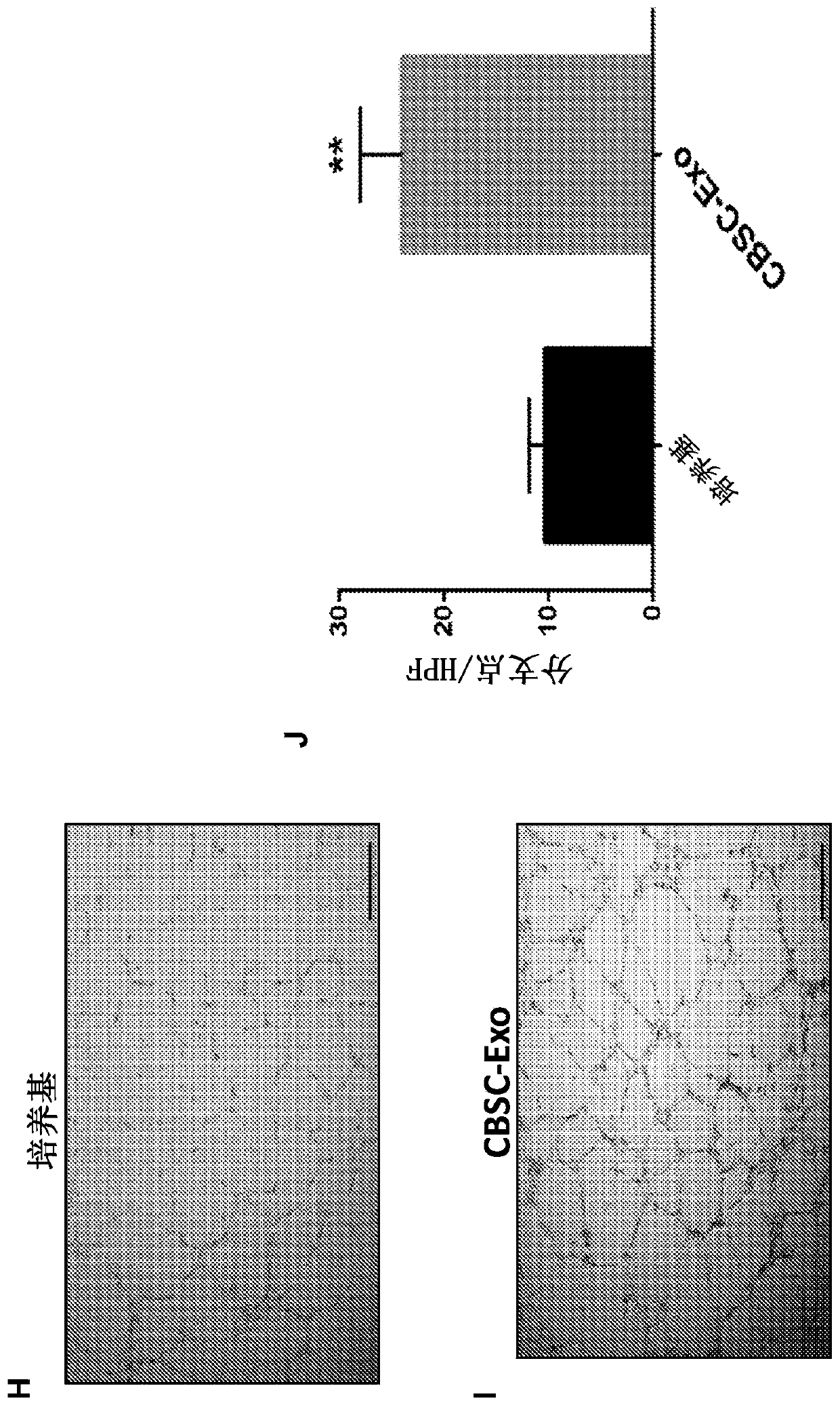 Augmenting heart function after cardiac injury with exosomes derived from cortical bone stem cells