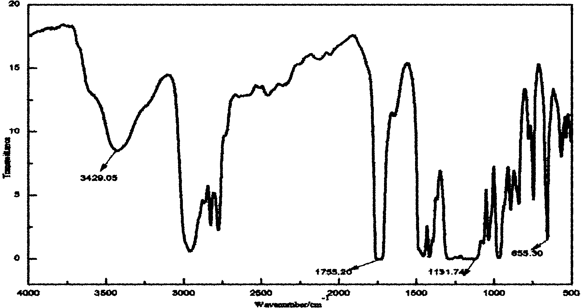 Fluorine-containing acrylate polymer anion exchange membrane and preparation method thereof