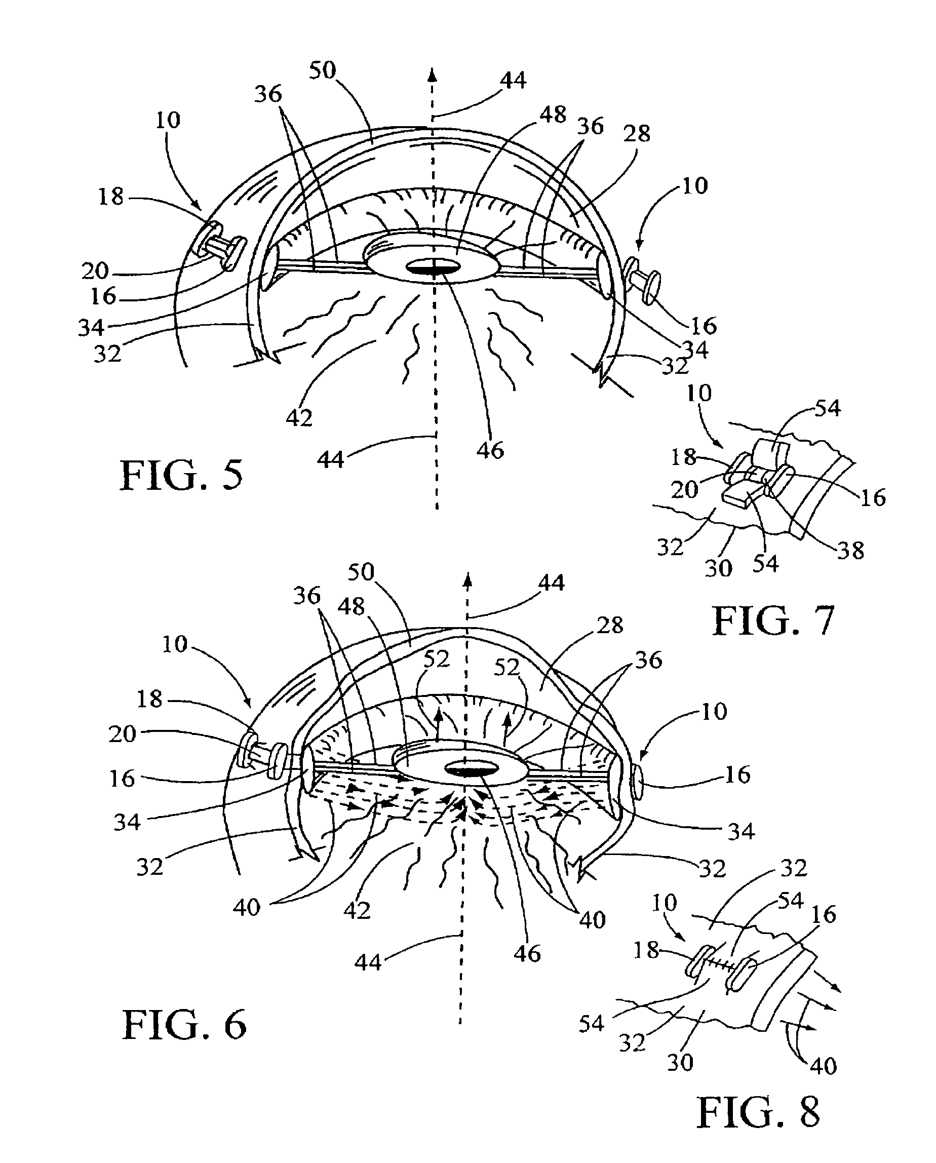 Reading enhancement device for preventing and treating presbyopia of the eye