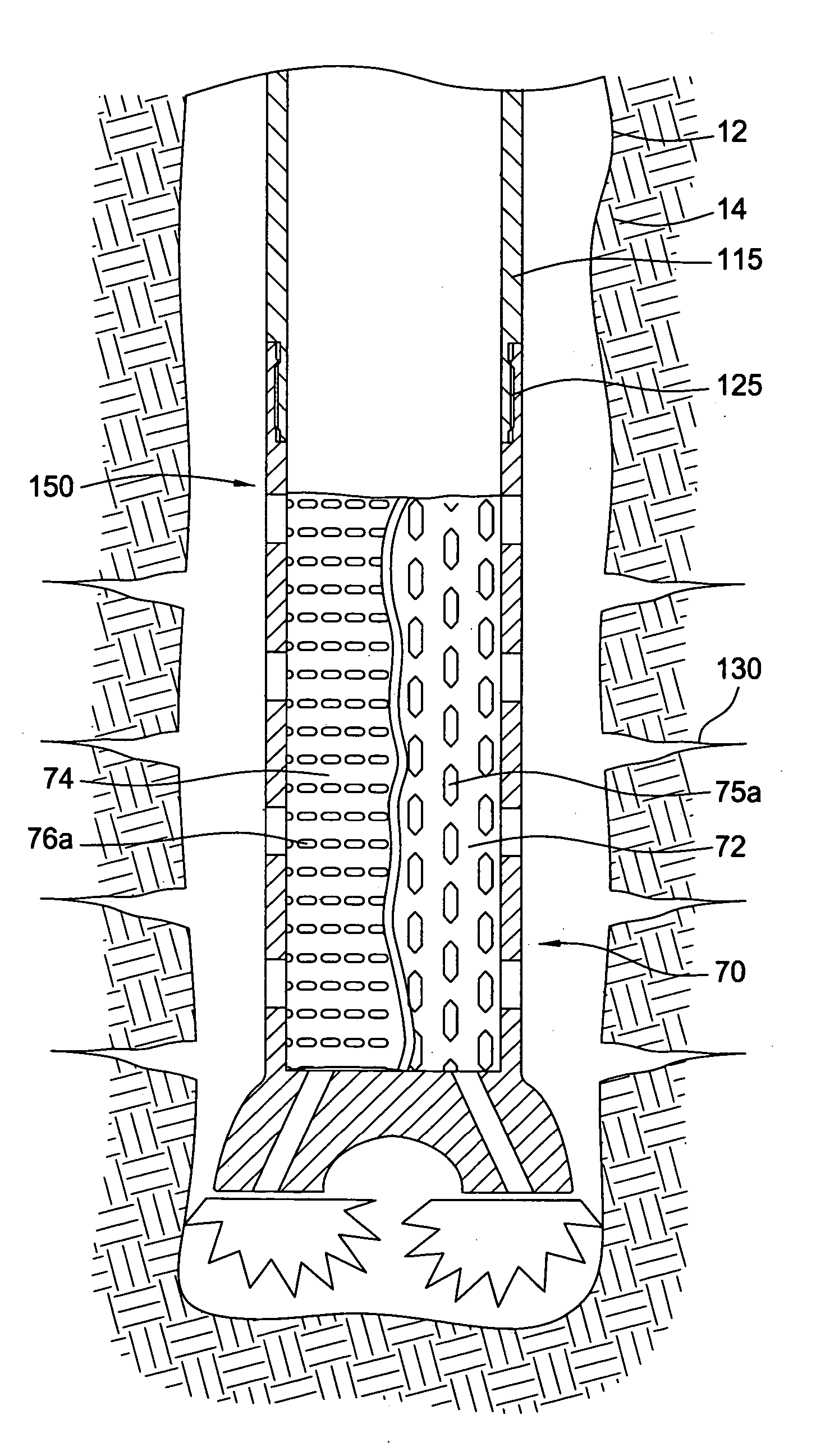 Downhole filter