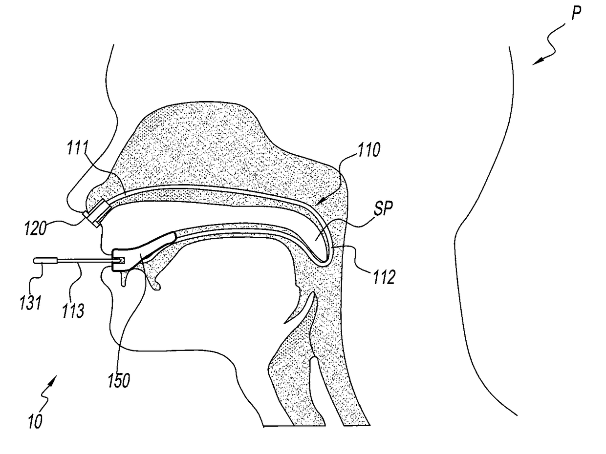 Apparatus and methods for the treatment of sleep apnea