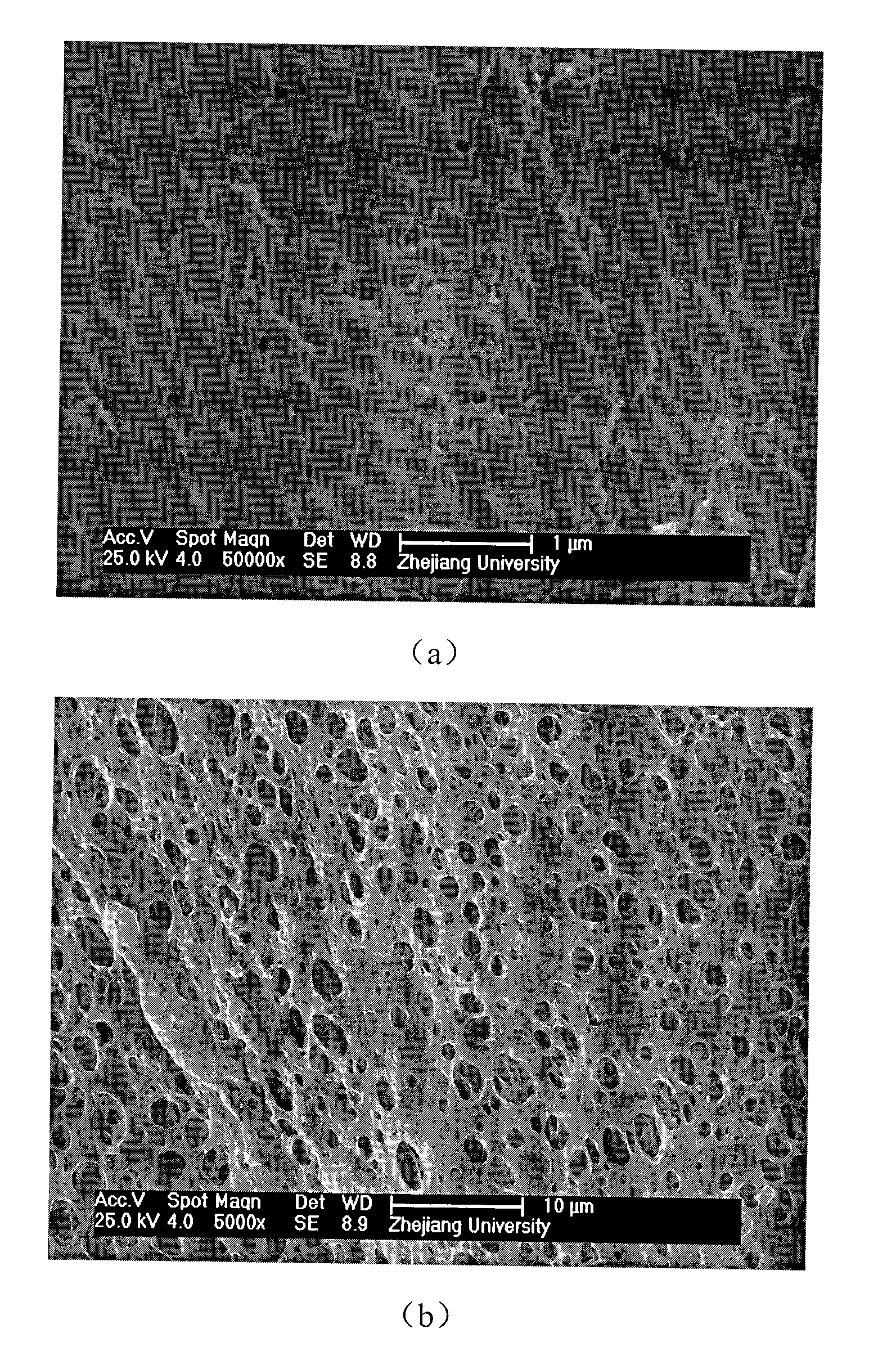 Method for preparing fiber braided tube embedded enhanced type polymer hollow fiber microporous membrane