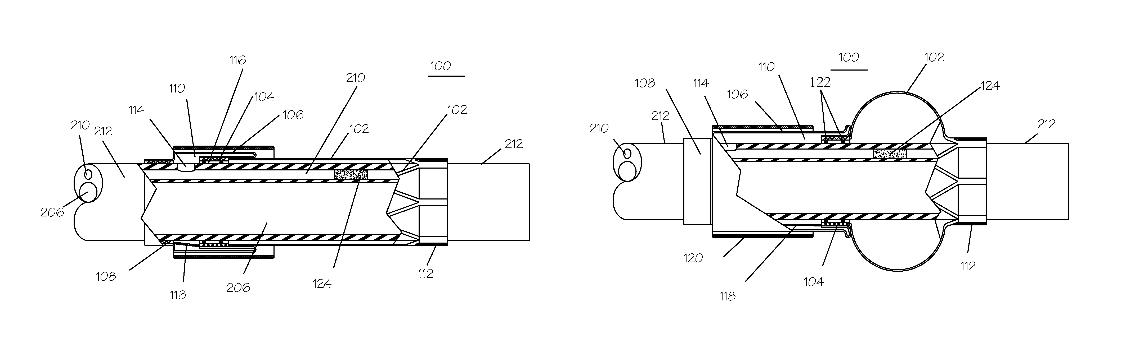 Pressure activated foreign body removal system and method of use