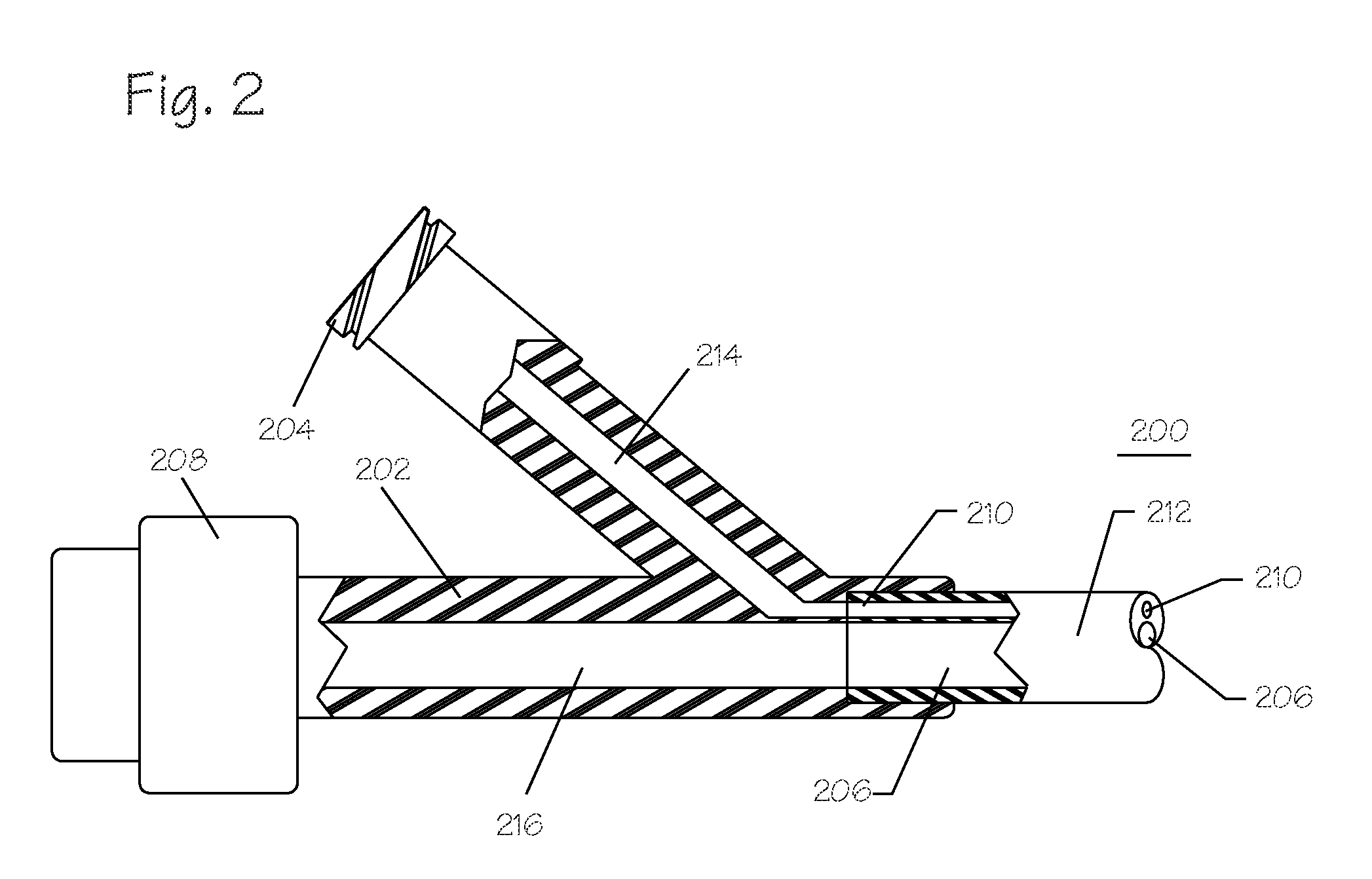 Pressure activated foreign body removal system and method of use