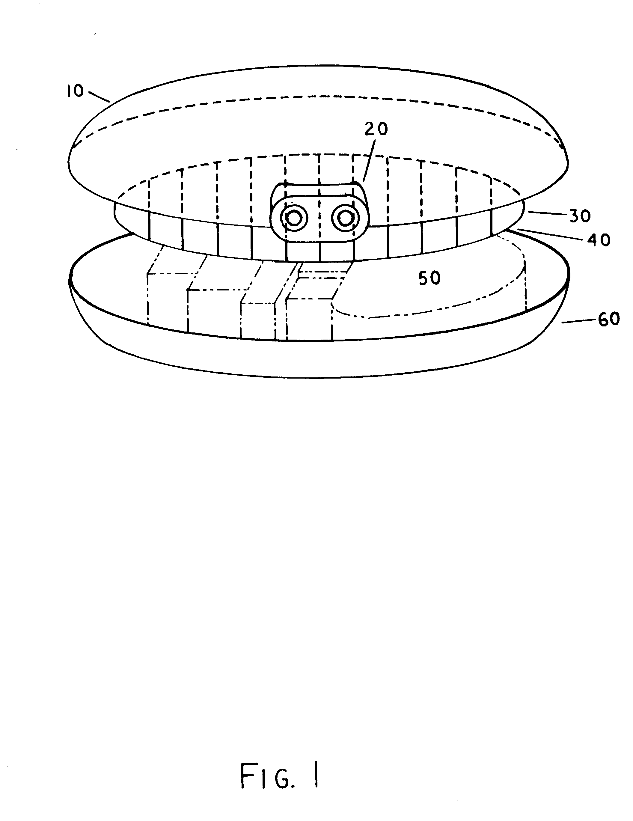 Subcutaneously implantable power supply