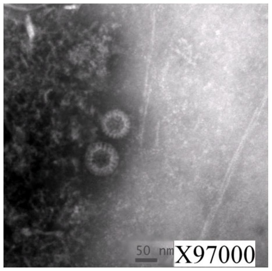 A kind of group A rotavirus nucleic acid detection standard substance and its preparation method and application