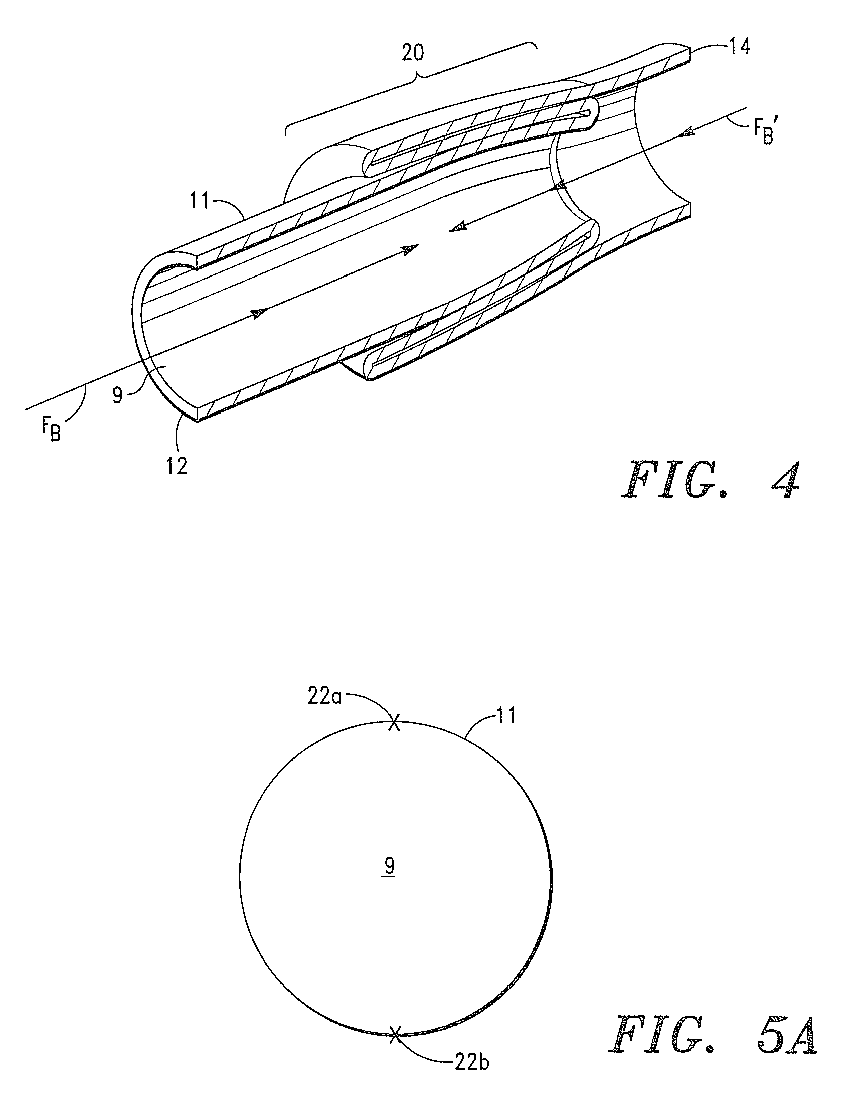 Tubular extracellular matrix prosthetic valve