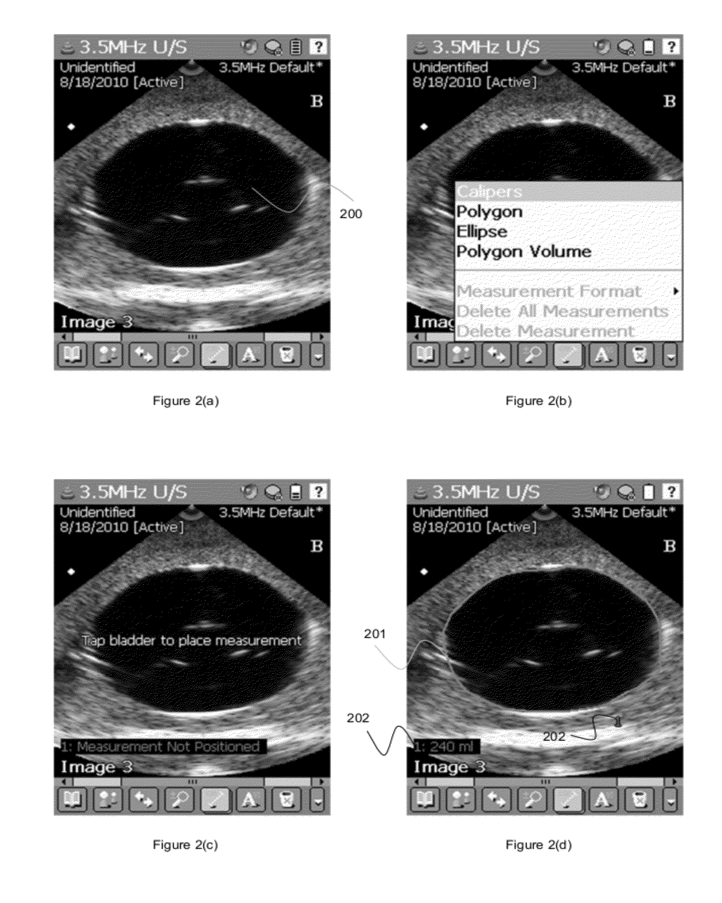 Method and apparatus for volume determination