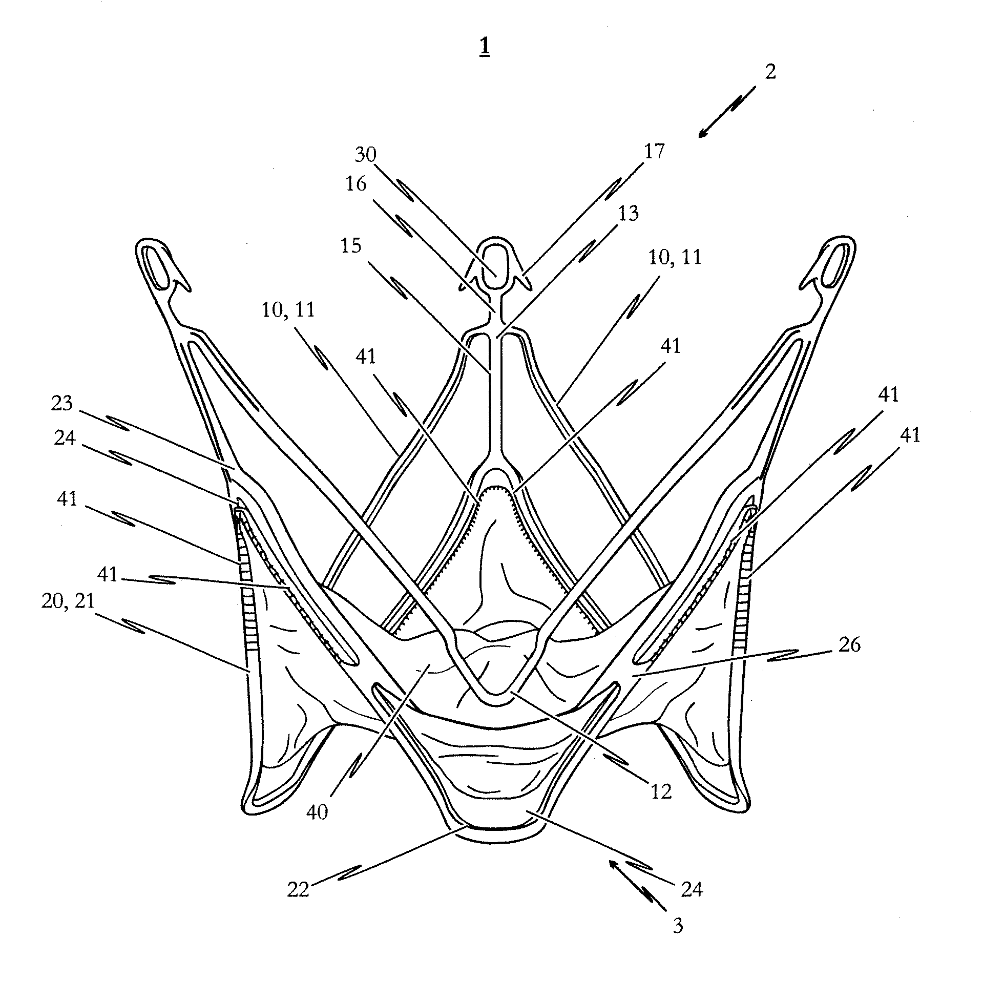 Medical Device for Treating A Heart Valve Insufficiency or Stenosis