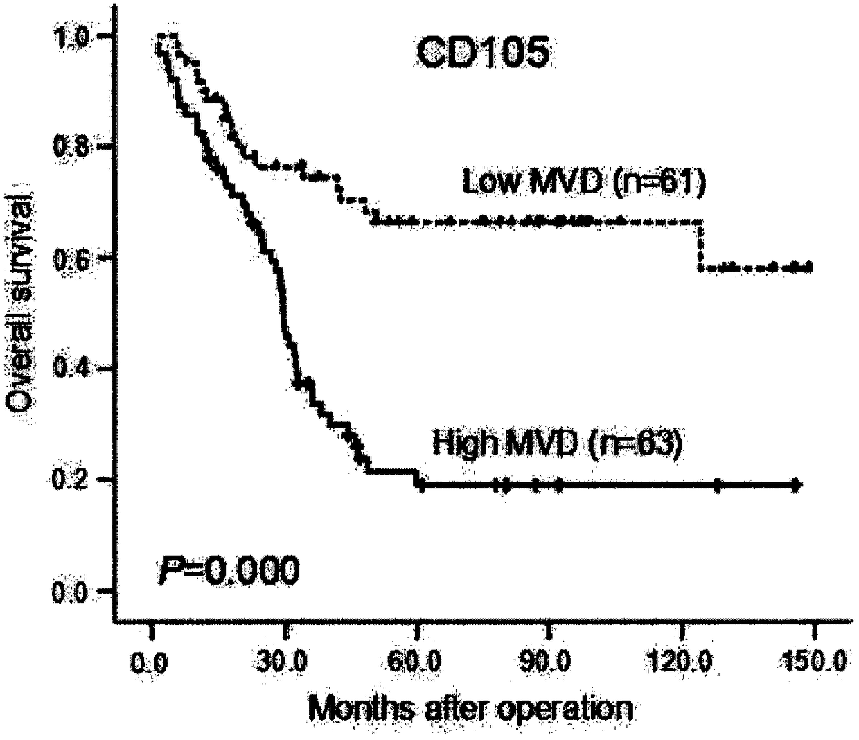 CD105, esvegr2 and myc triple protein joint prediction kit for the prognosis of patients with esophageal squamous cell carcinoma