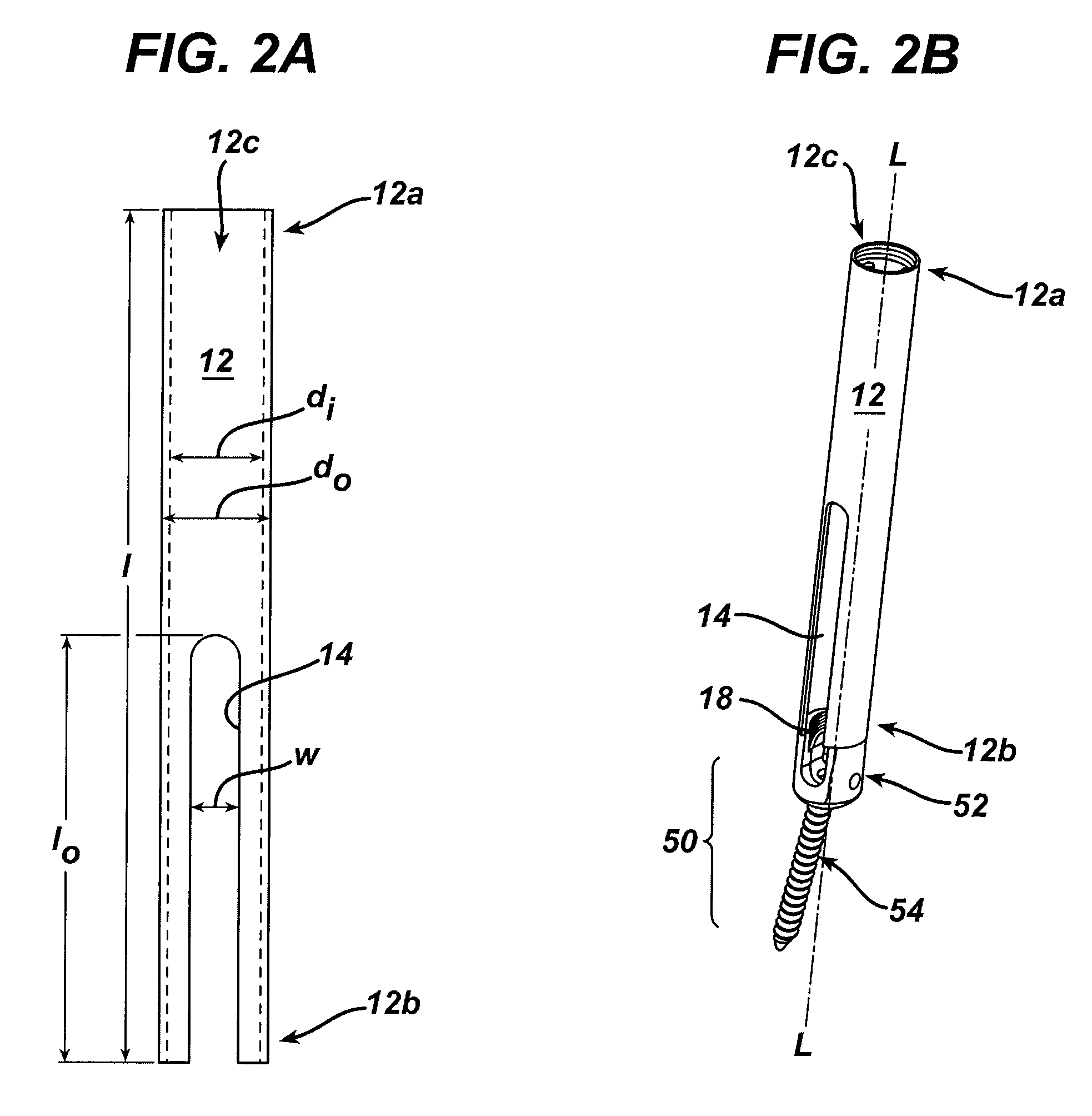 Spinal fixation element and methods