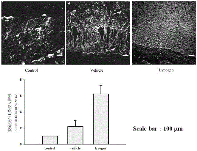 Application of Lycogen in preparing medical composition for promoting diabetes wound healing and inhibiting cancer metastasis in adjunctive manner