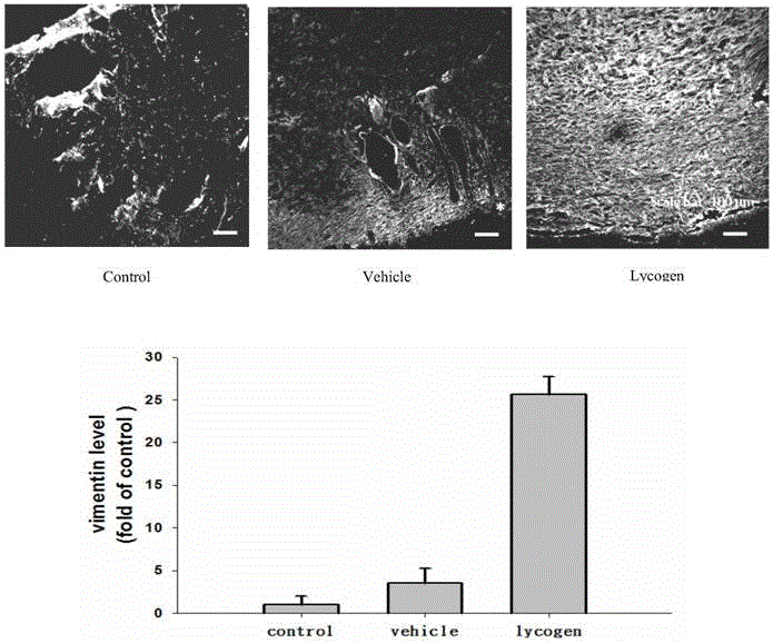 Application of Lycogen in preparing medical composition for promoting diabetes wound healing and inhibiting cancer metastasis in adjunctive manner