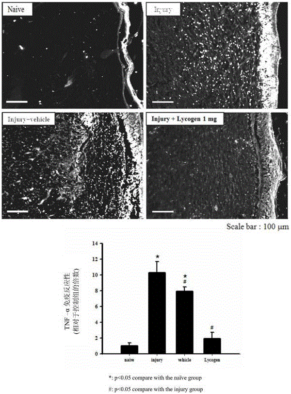 Application of Lycogen in preparing medical composition for promoting diabetes wound healing and inhibiting cancer metastasis in adjunctive manner