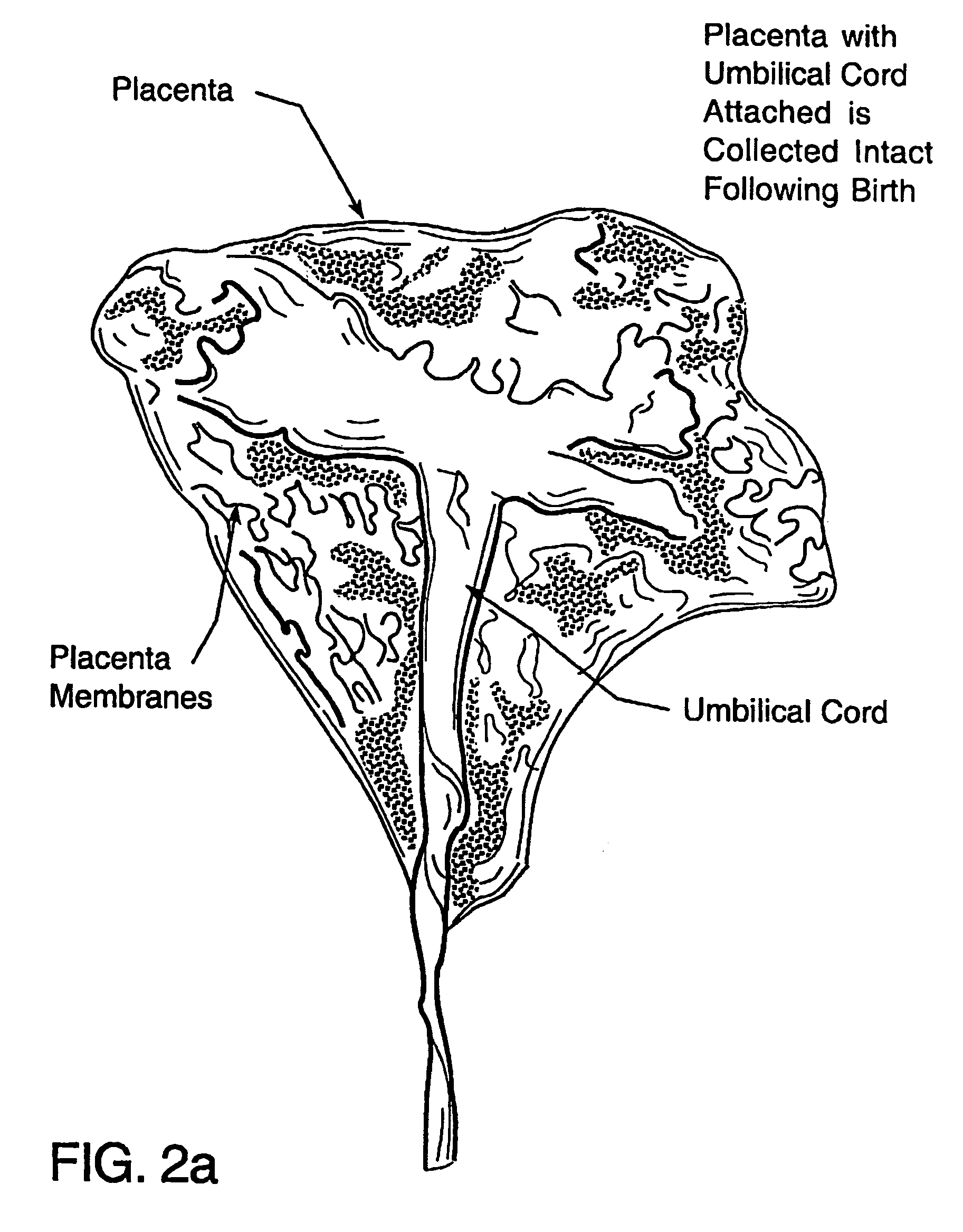 Tissue matrices comprising placental stem cells, and methods of making the same