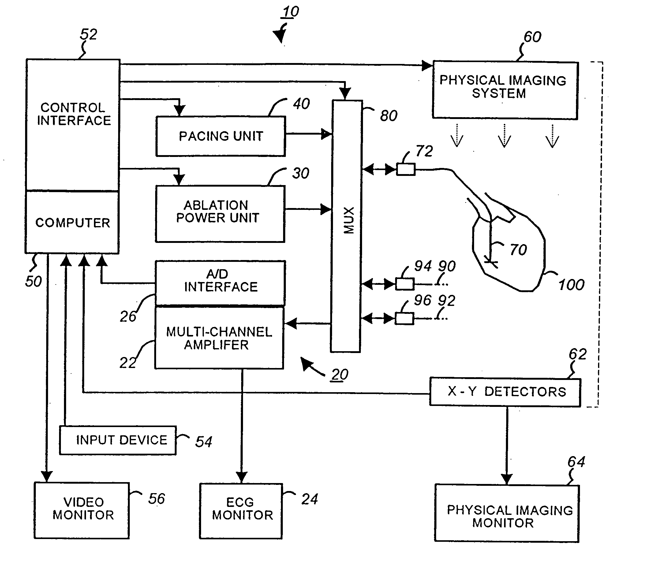 Apparatus and method for cardiac ablation