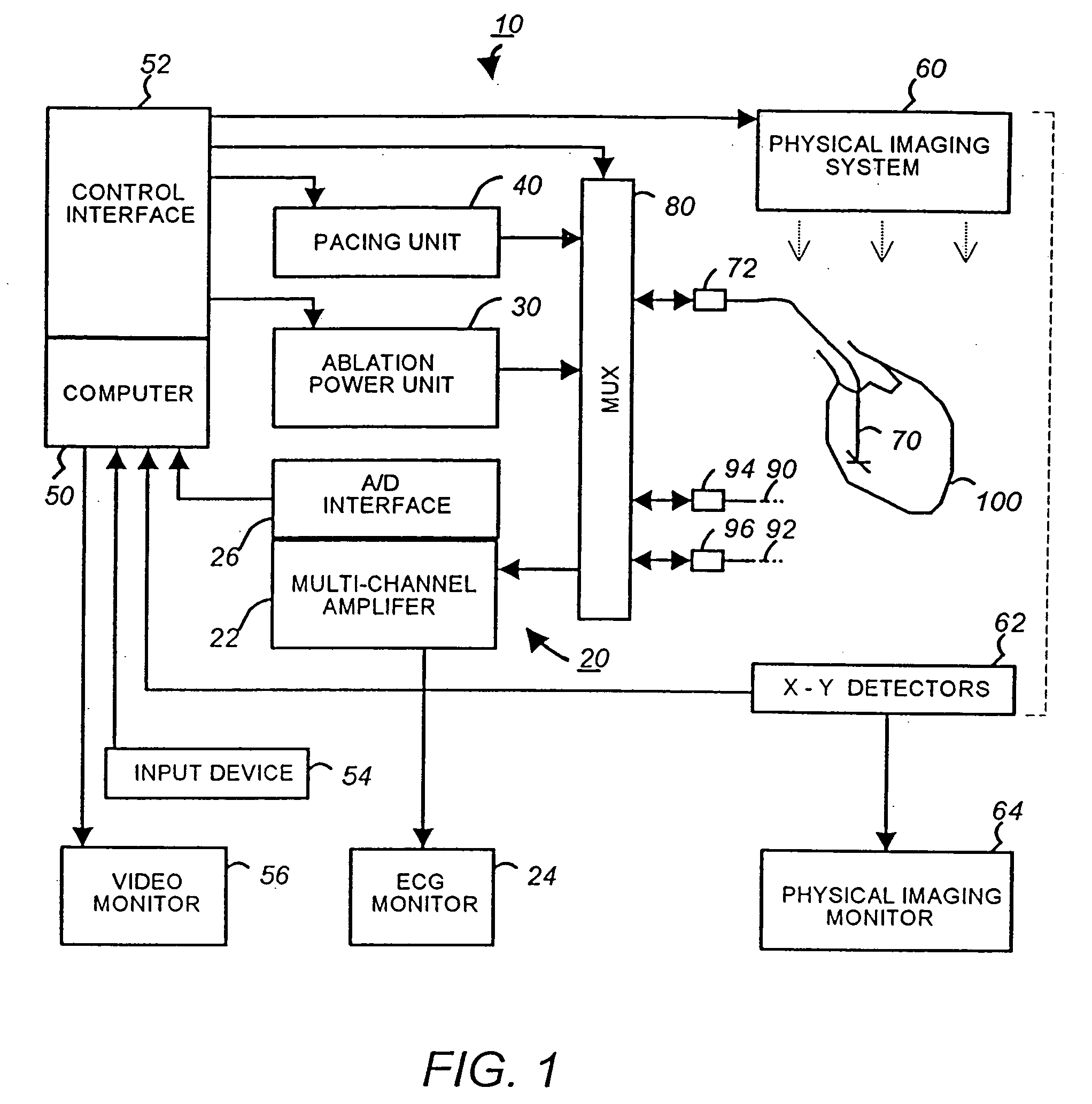 Apparatus and method for cardiac ablation