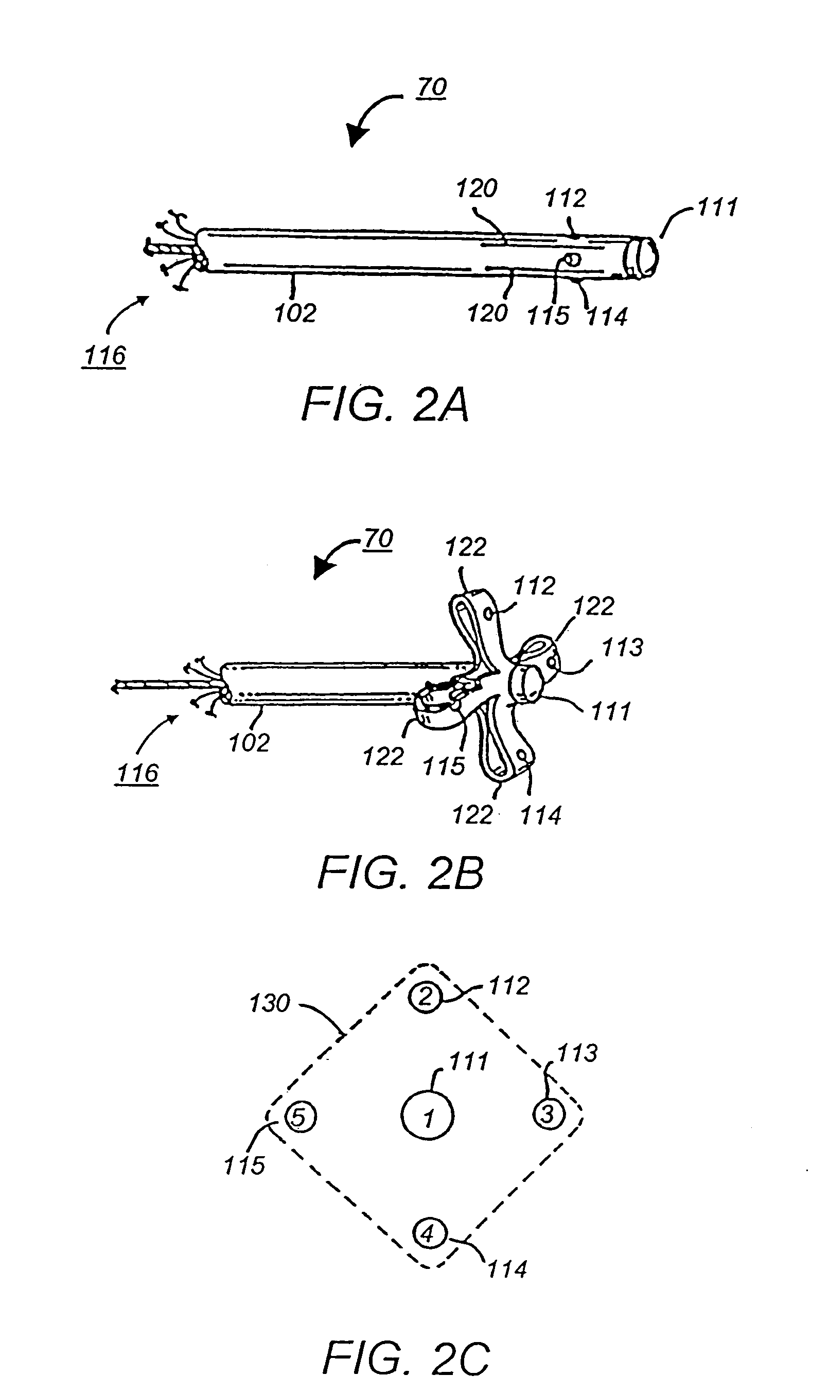 Apparatus and method for cardiac ablation