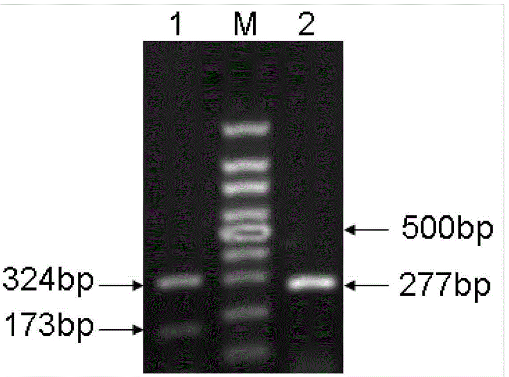 Application of tgf-β1 expressed by dendritic cells in the preparation of anti-atherosclerotic drugs