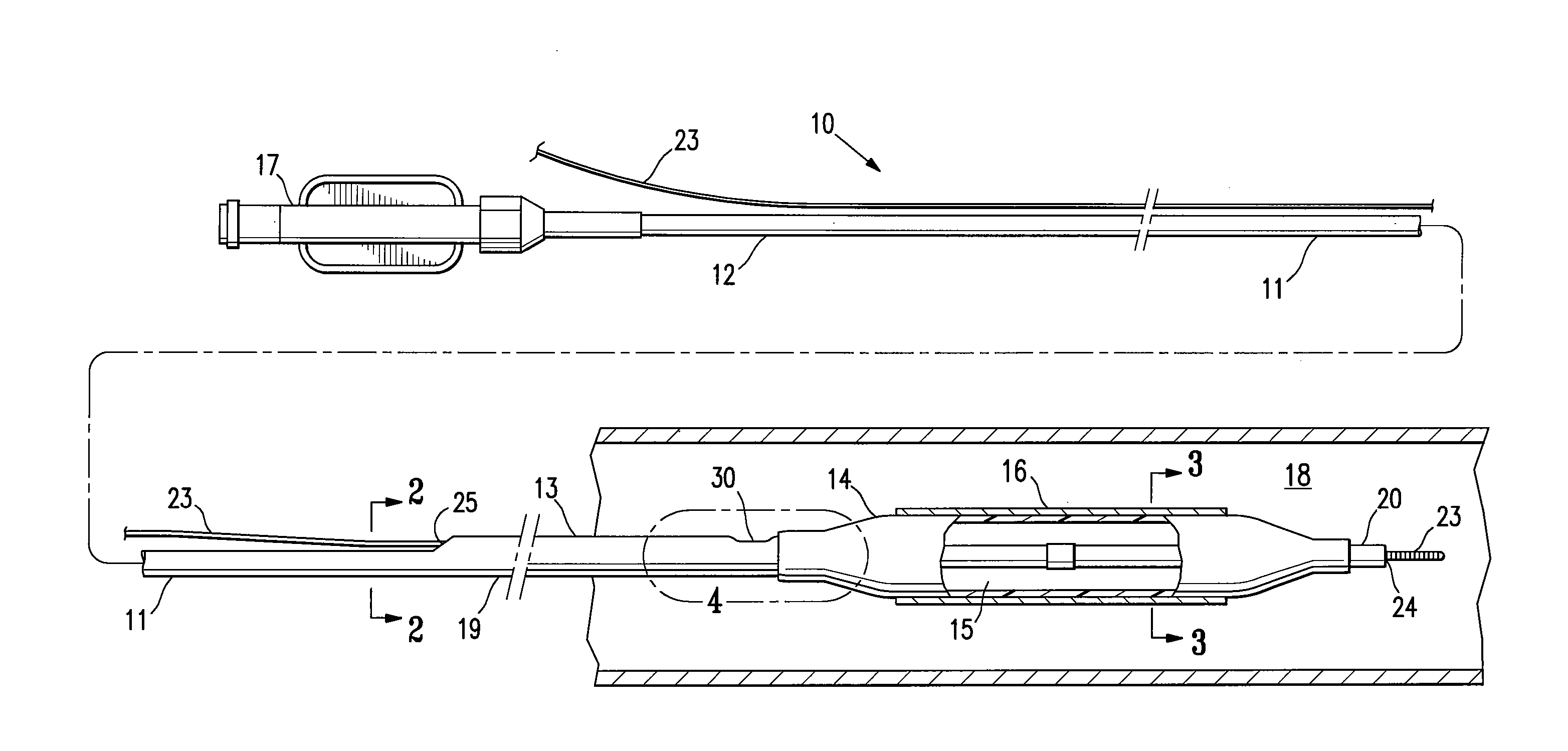 Balloon catheter having a shaft with a variable stiffness inner tubular member