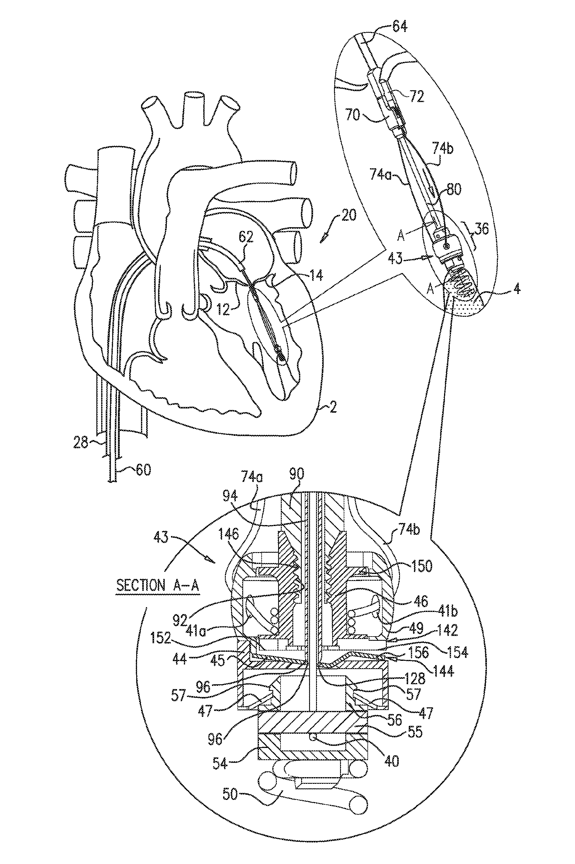 Techniques for guide-wire based advancement of a tool