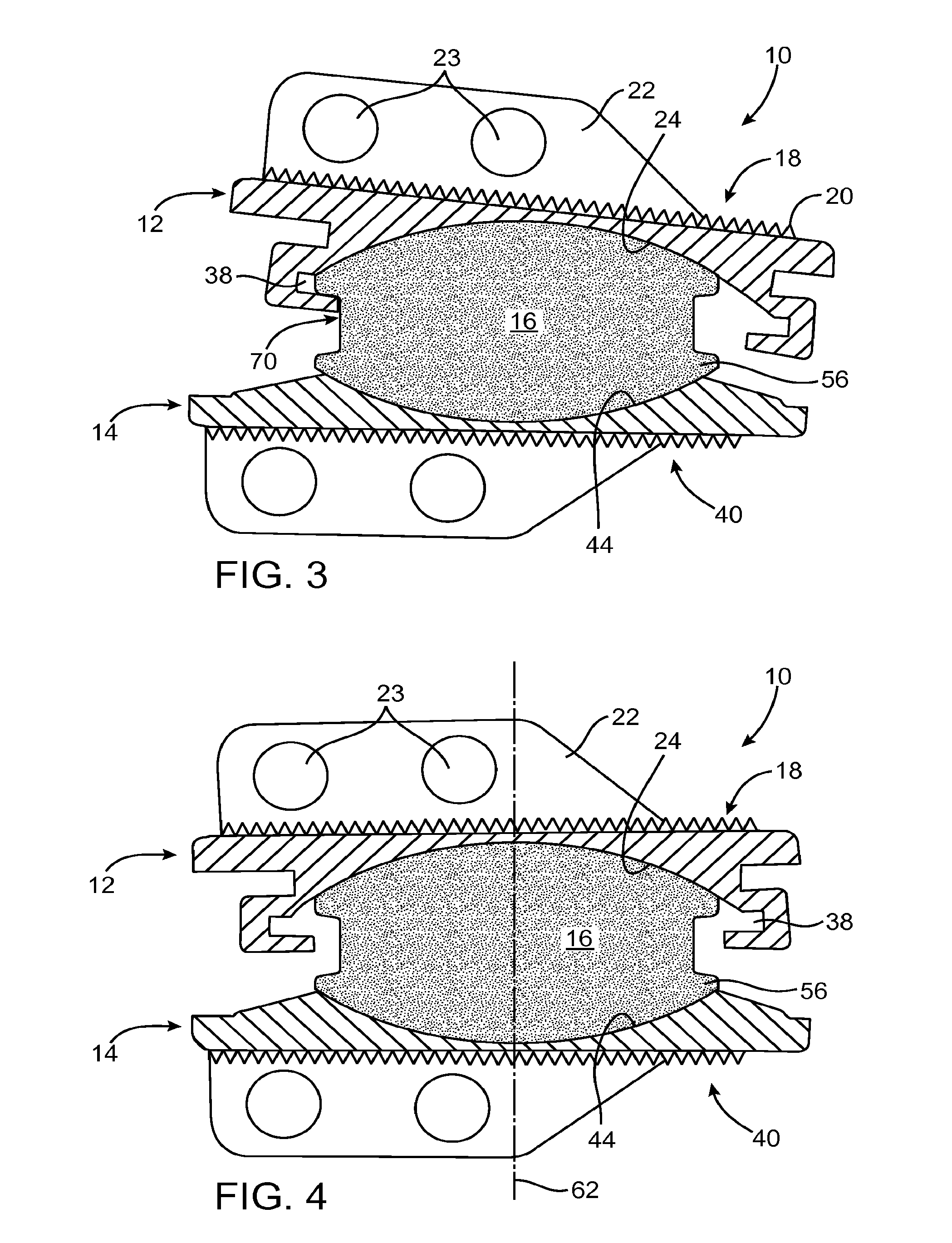 Prosthetic disc for intervertebral insertion