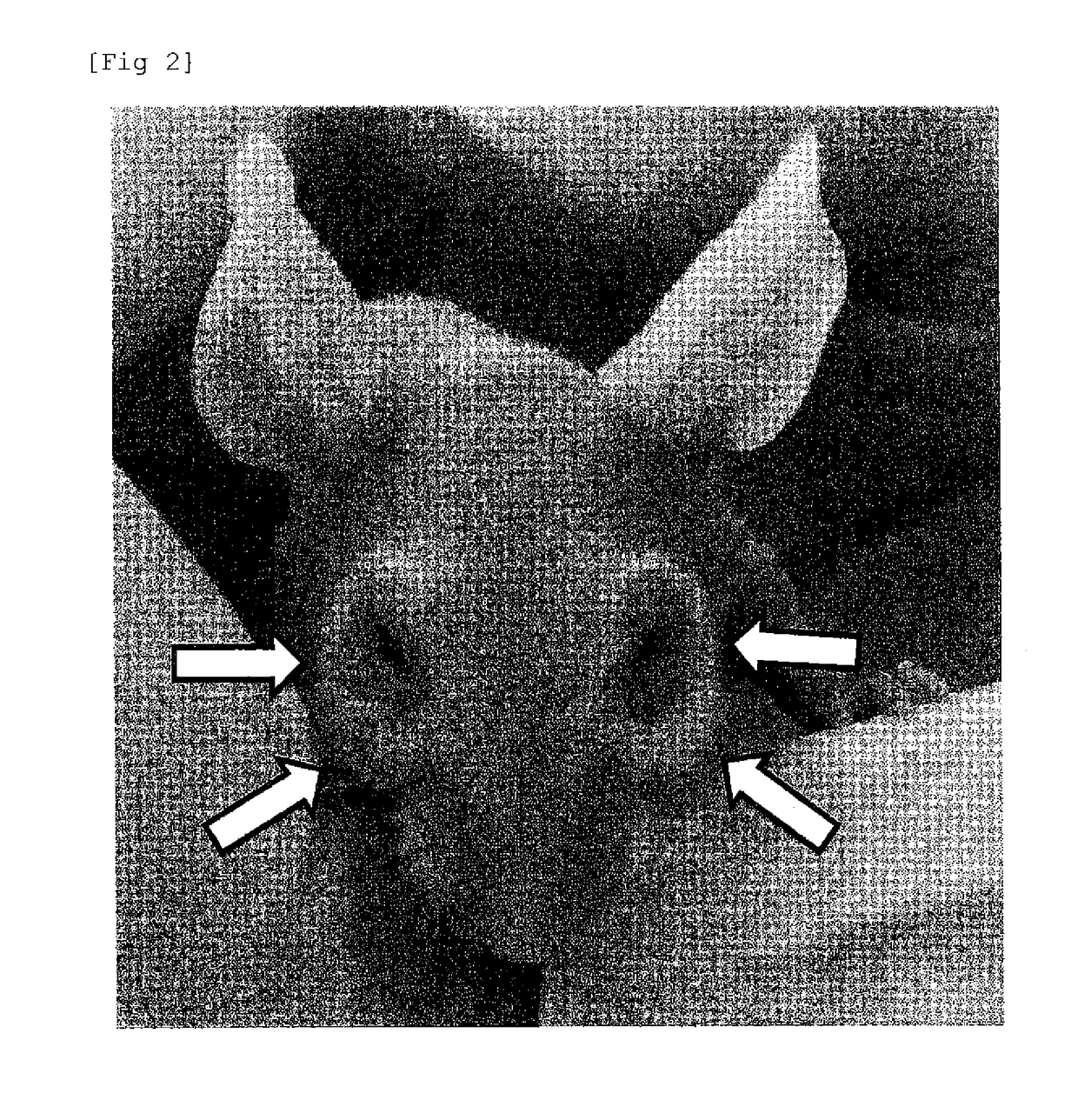 Antibody against alopecia-inducing substance as antigen, composition and production method