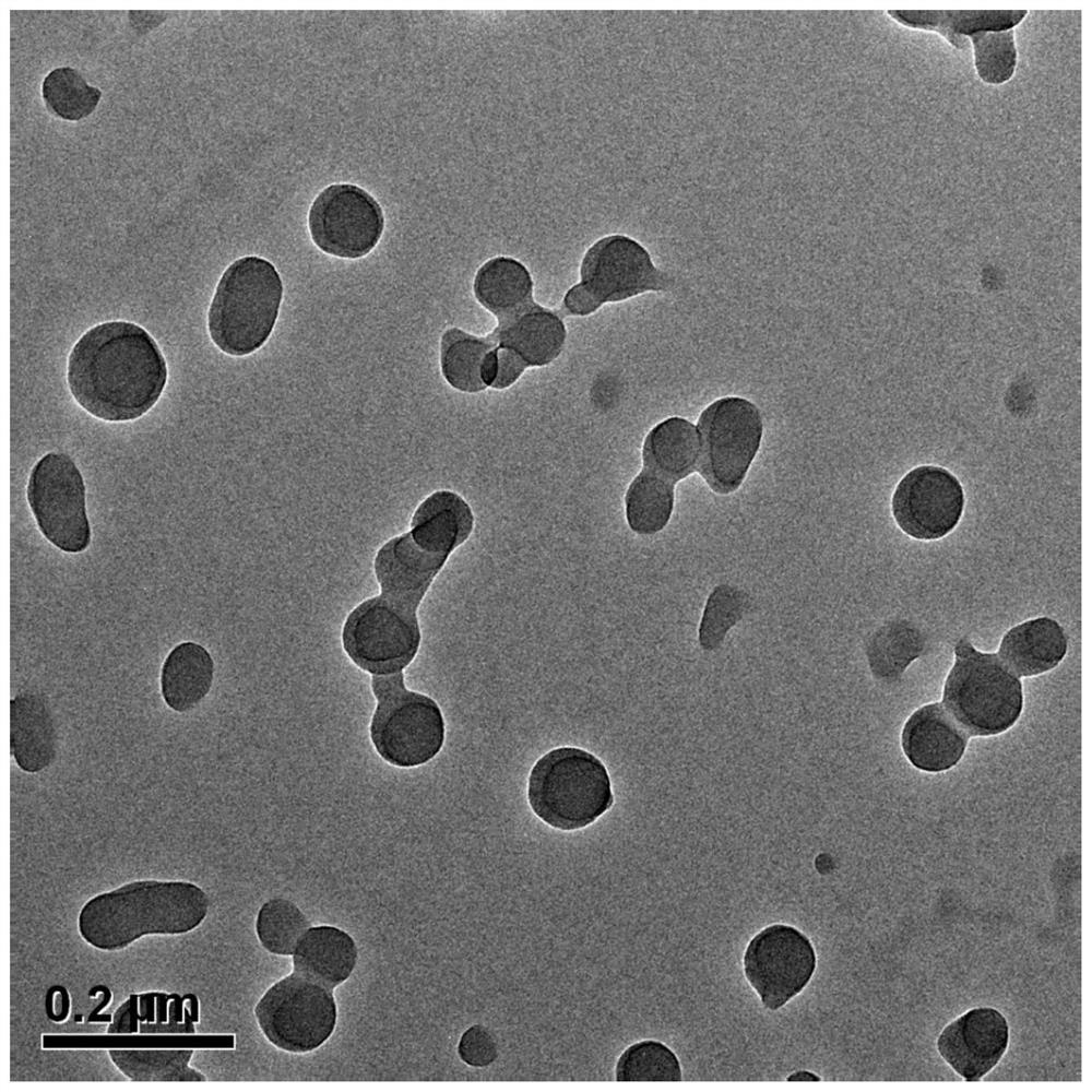 Preparation method and application of tripterine nanomedicine coated with hyaluronic acid