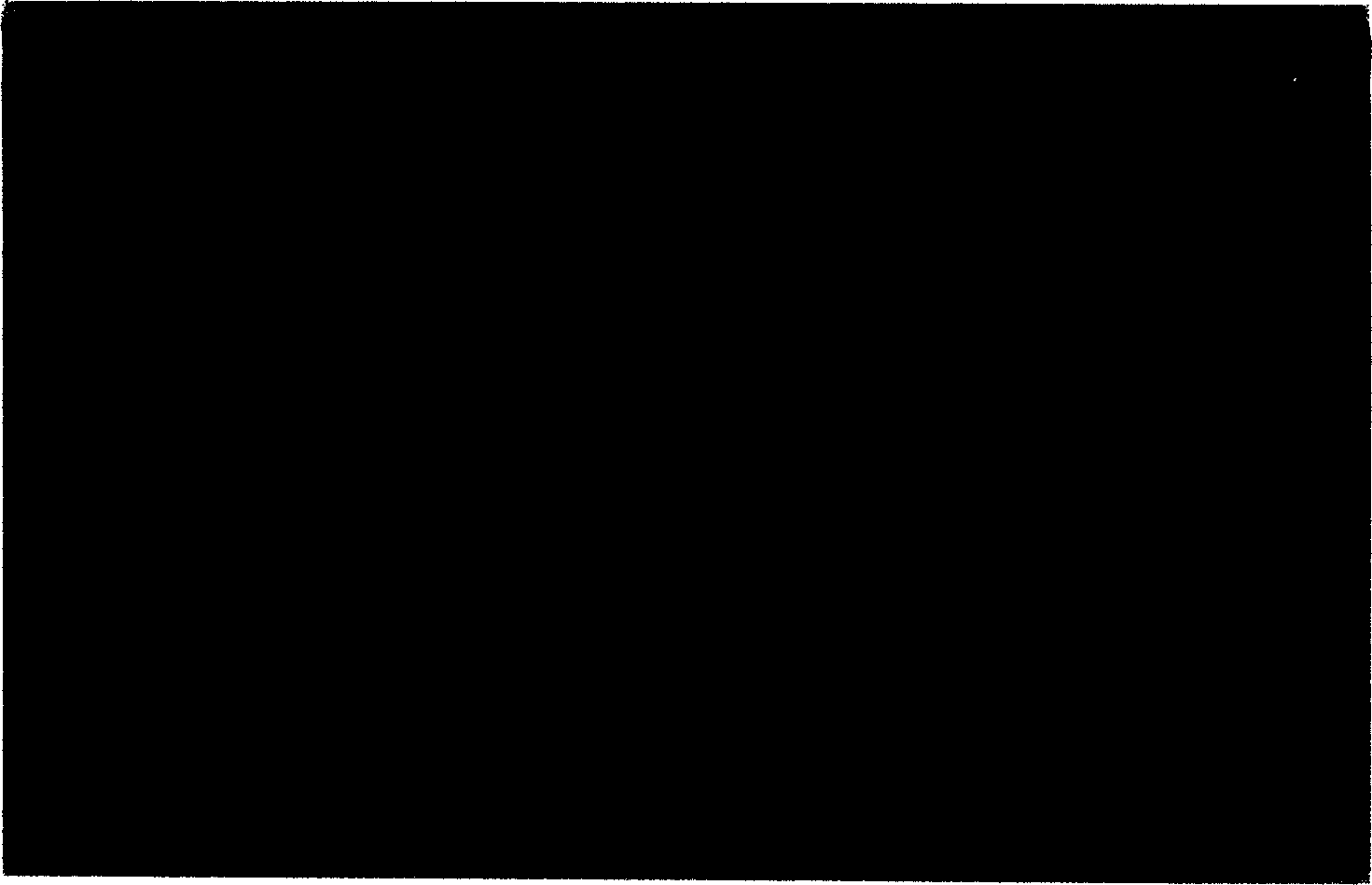 Chitin-sodium alginate packed pylorus helicobacterium protein microballs and their preparation