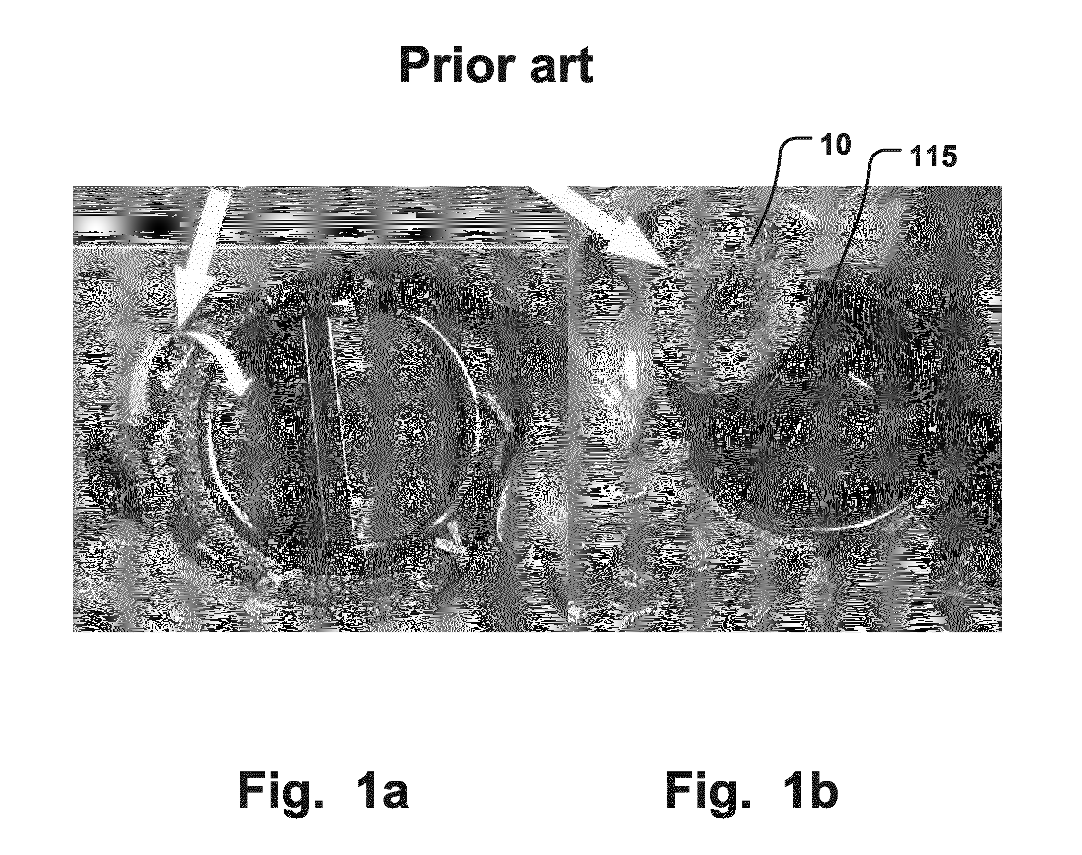 Medical Implantable Occlusion Device, And Method For Implantation Thereof