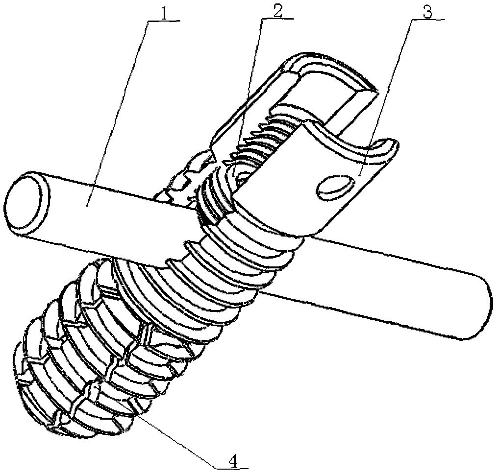 Full built-in expandable anterior spinal fixation system