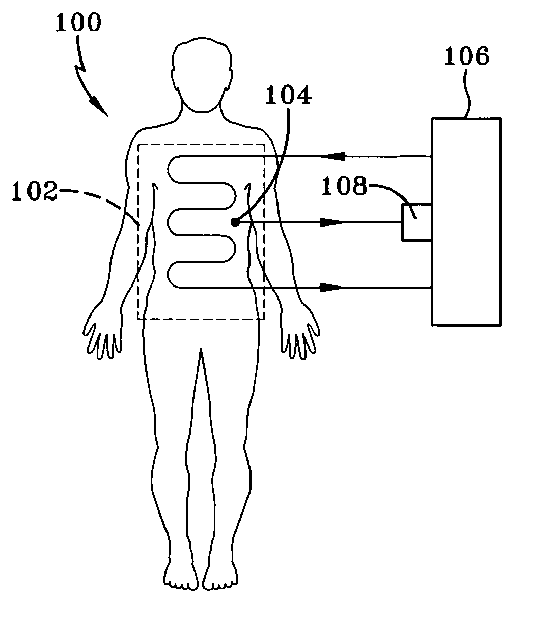 Body thermoregulation using skin temperature feedback