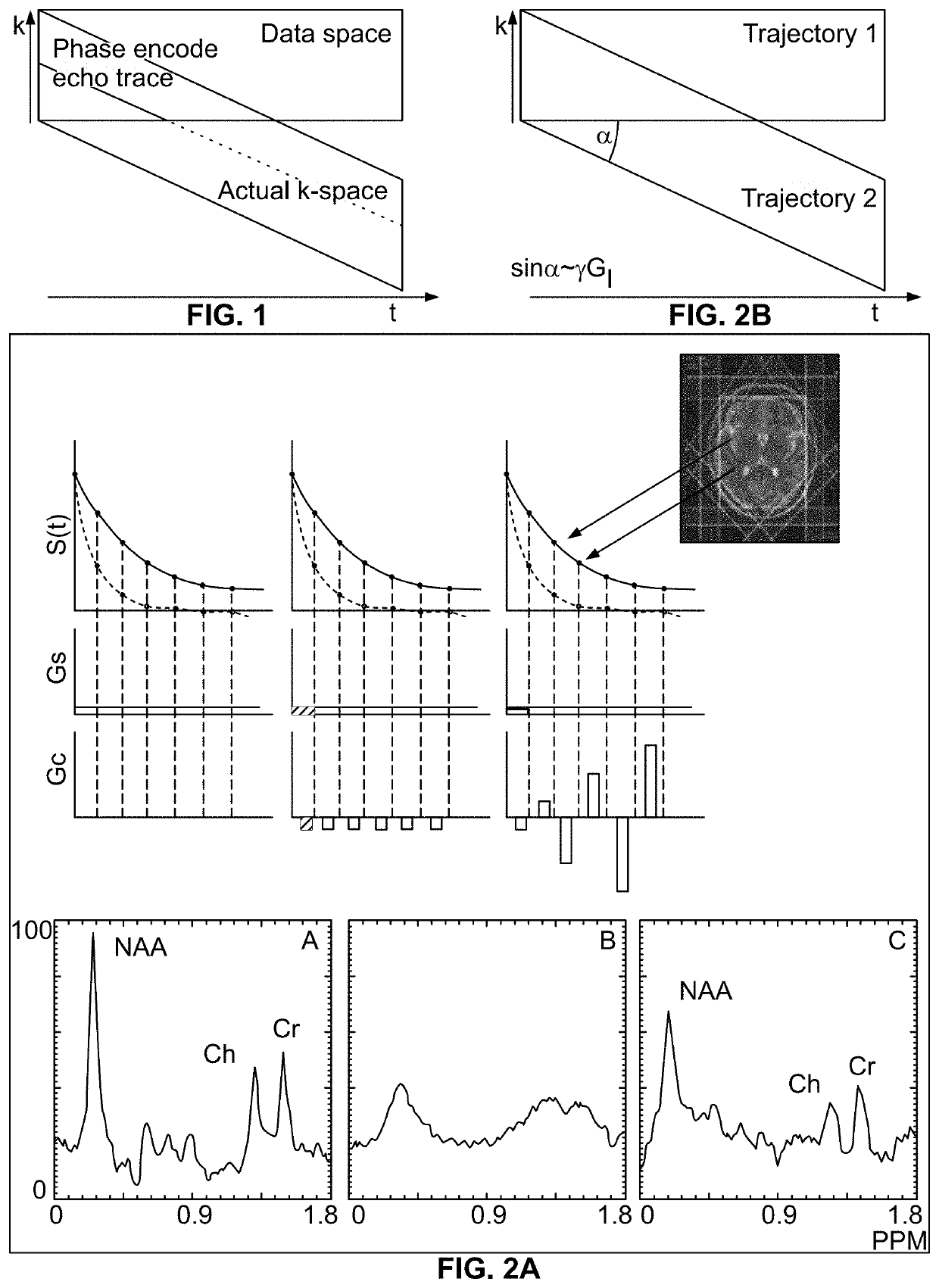 Compensation of magnetic field inhomogeneity in MR spectroscopic imaging using dynamic k-space expansion in combination with parallel imaging