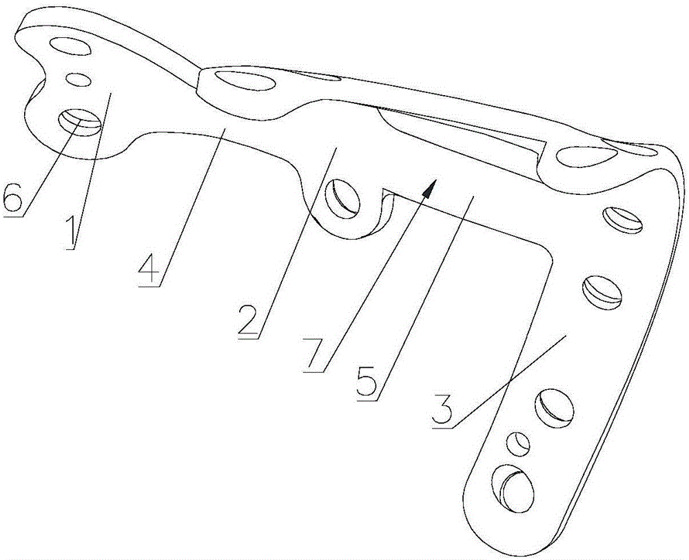 Fusion board for talonavicular and naviculocuneiform joints