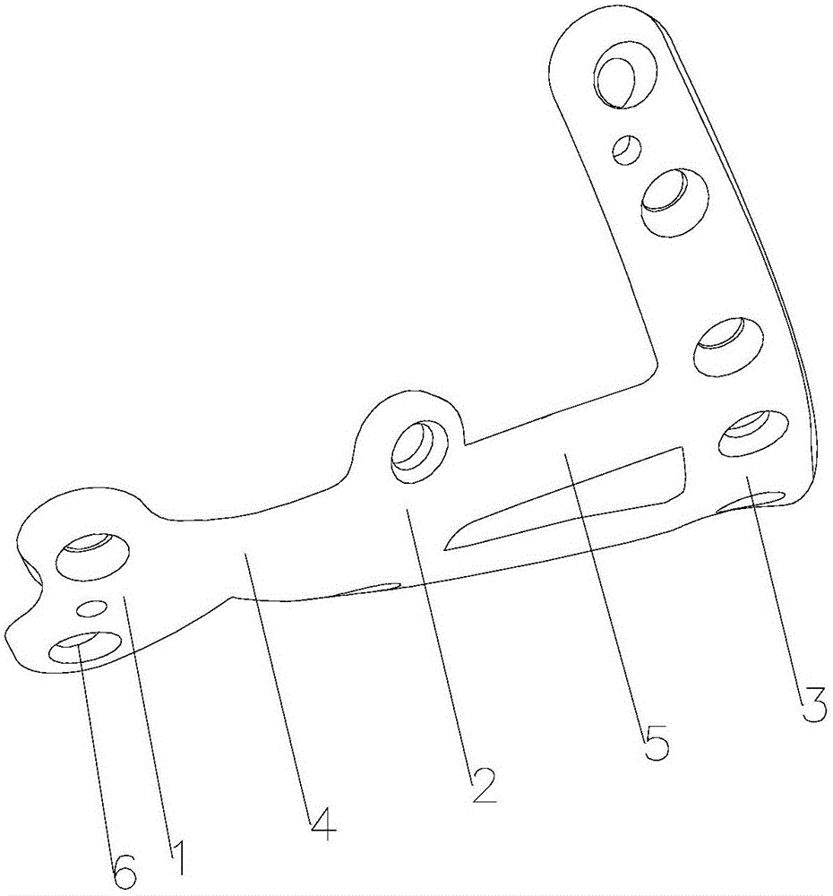 Fusion board for talonavicular and naviculocuneiform joints