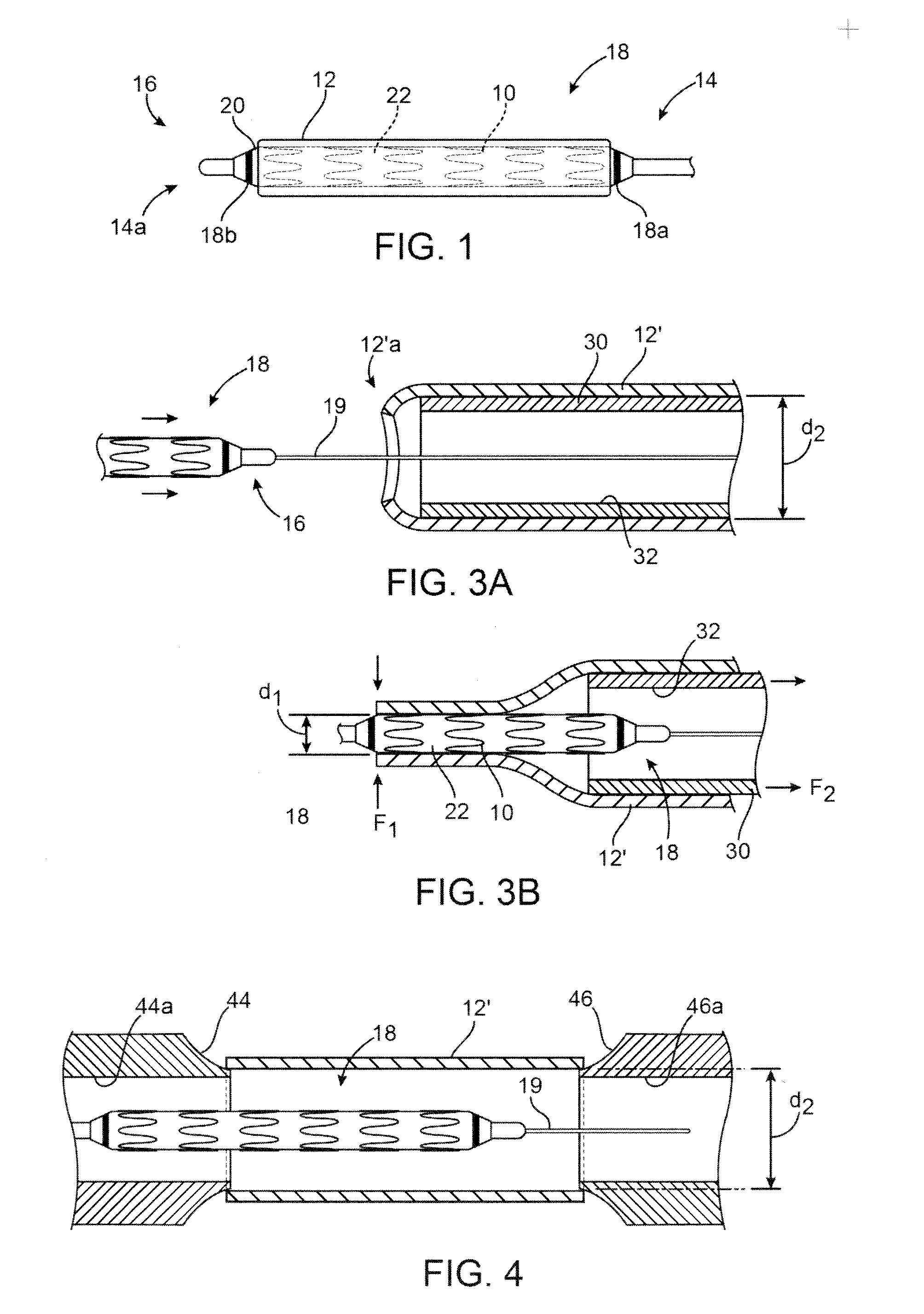 Sheaths Used in Polymer Scaffold Delivery Systems