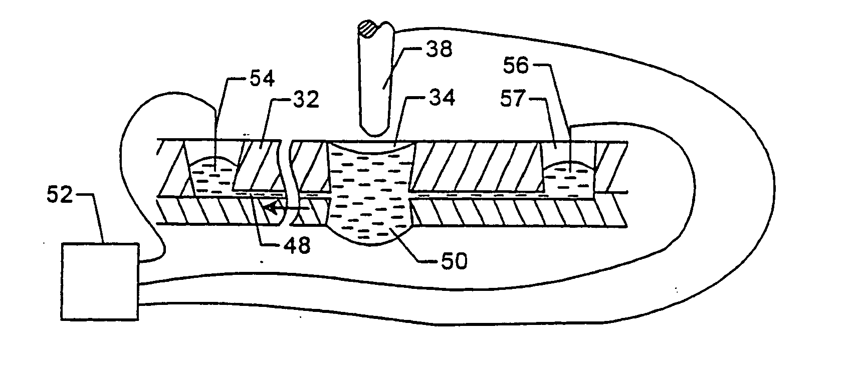 Microfabricated structures for facilitating fluid introduction into microfluidic devices