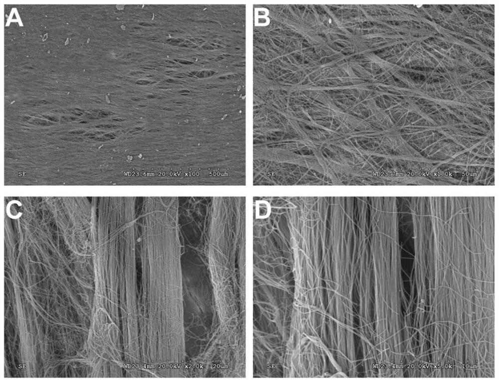 Acellular matrix urethral suspension repair material and its preparation method and application