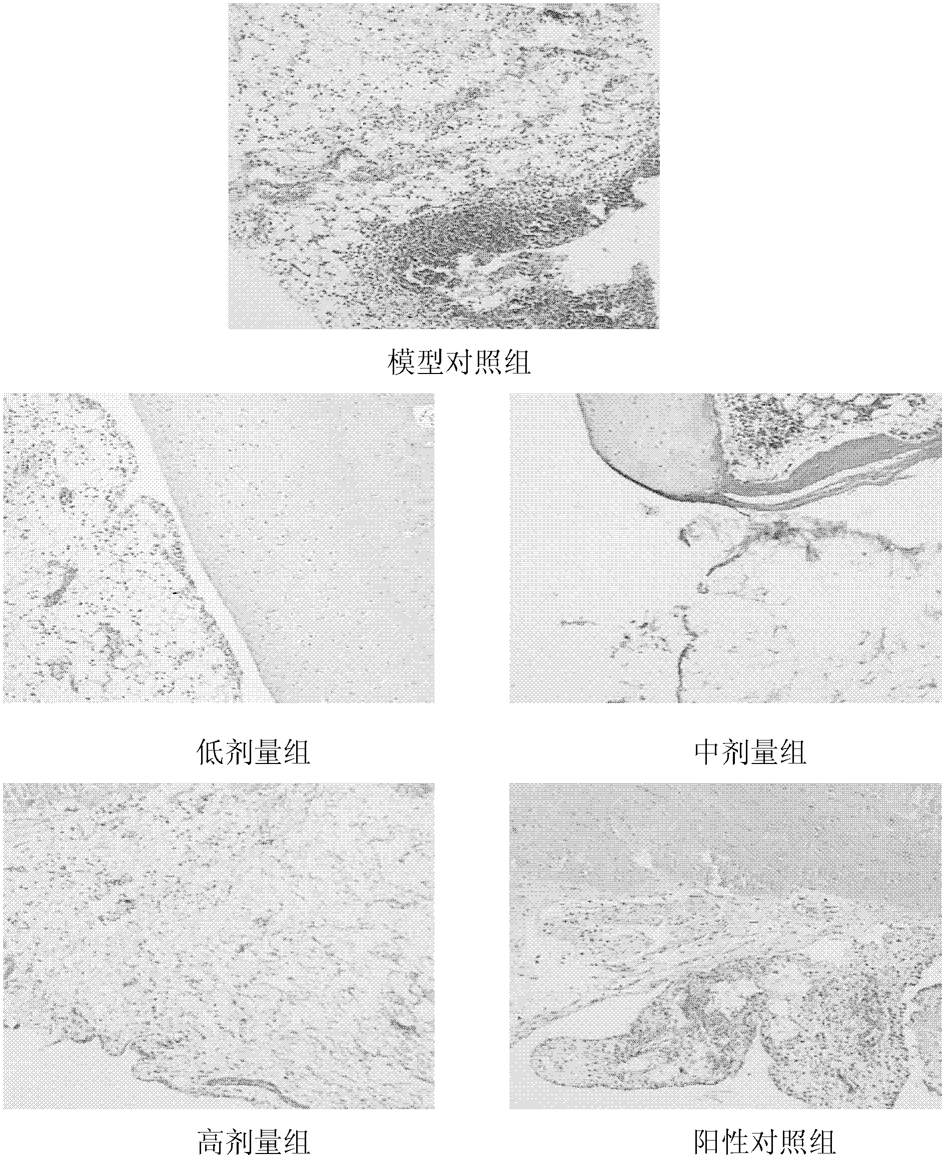 Application of pawpaw total phenolic acid extract in preparation of arthritis prevention and treatment medicaments or food