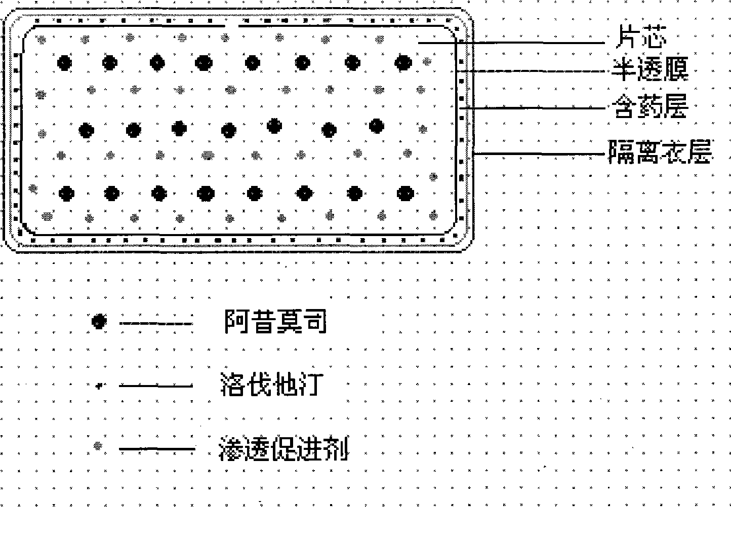 Osmotic pump controlled release preparation composition for treating hyperlipemia and preparation method thereof