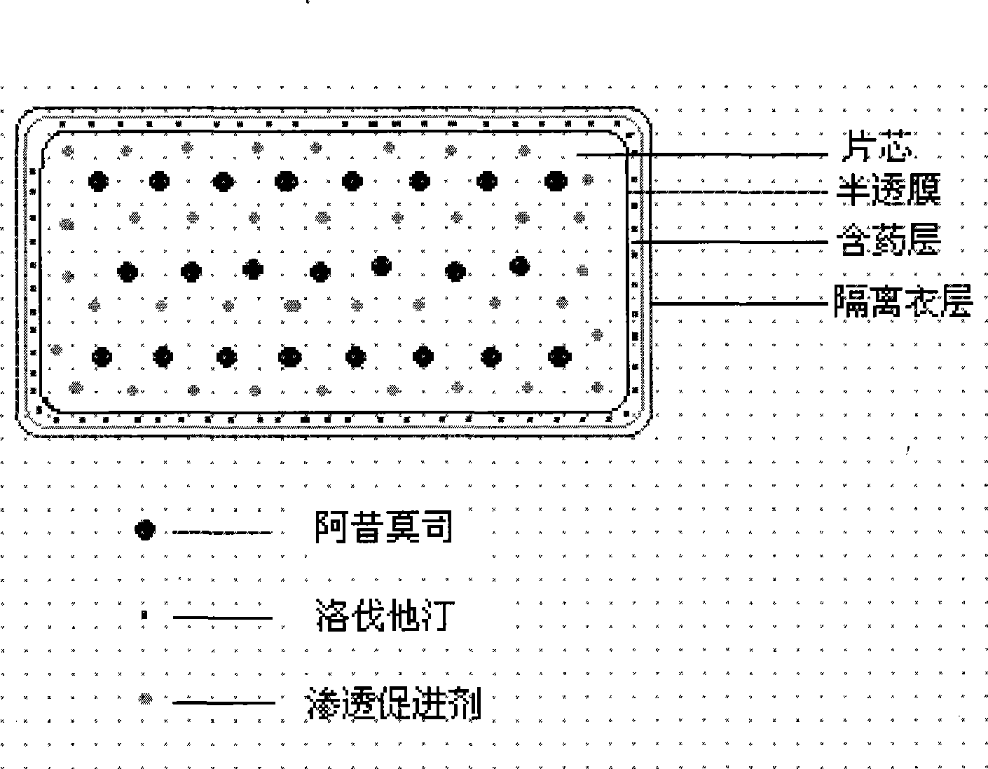 Osmotic pump controlled release preparation composition for treating hyperlipemia and preparation method thereof